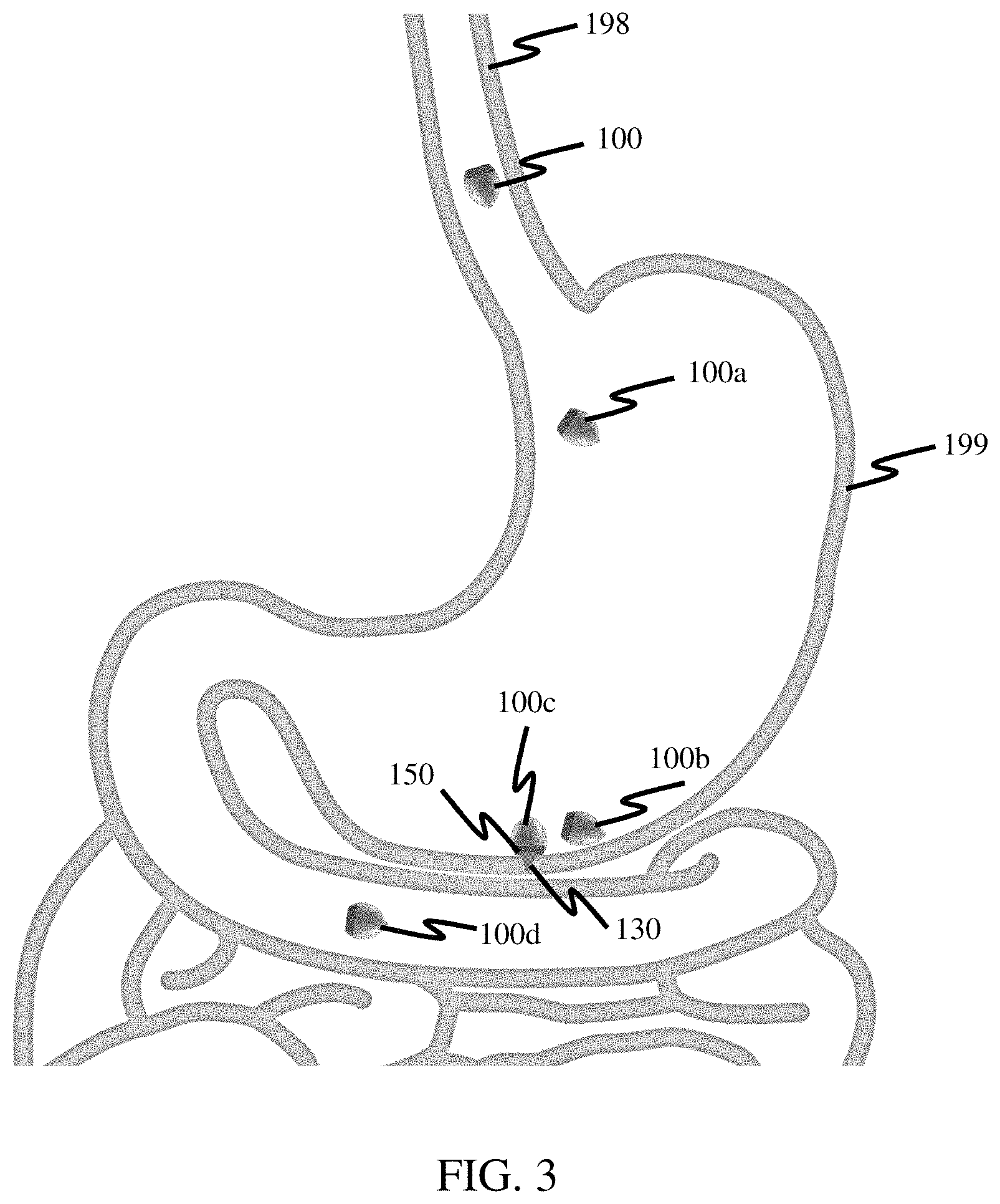 Patent US11771829 Figure 3 – Systems and methods for liquid injection
