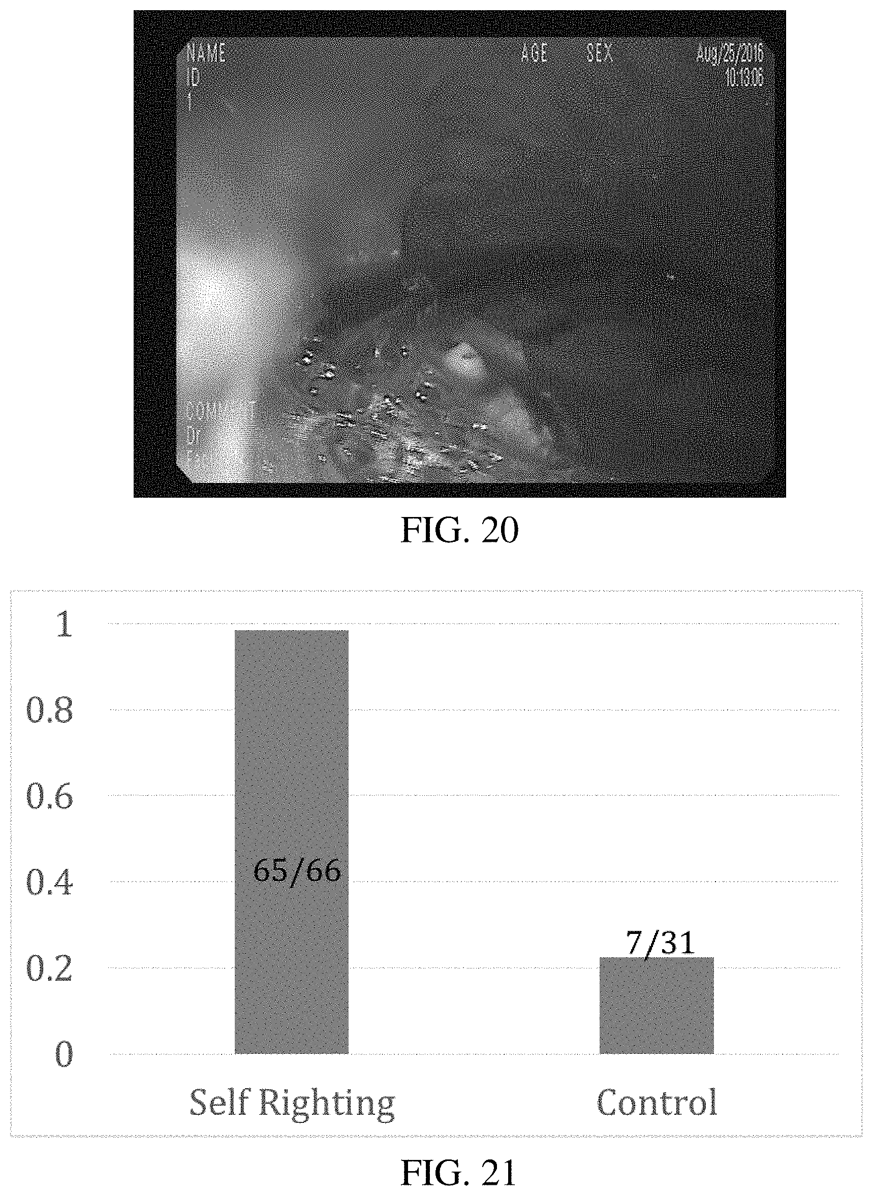 Patent US11771829 Figure 20 – Systems and methods for liquid injection