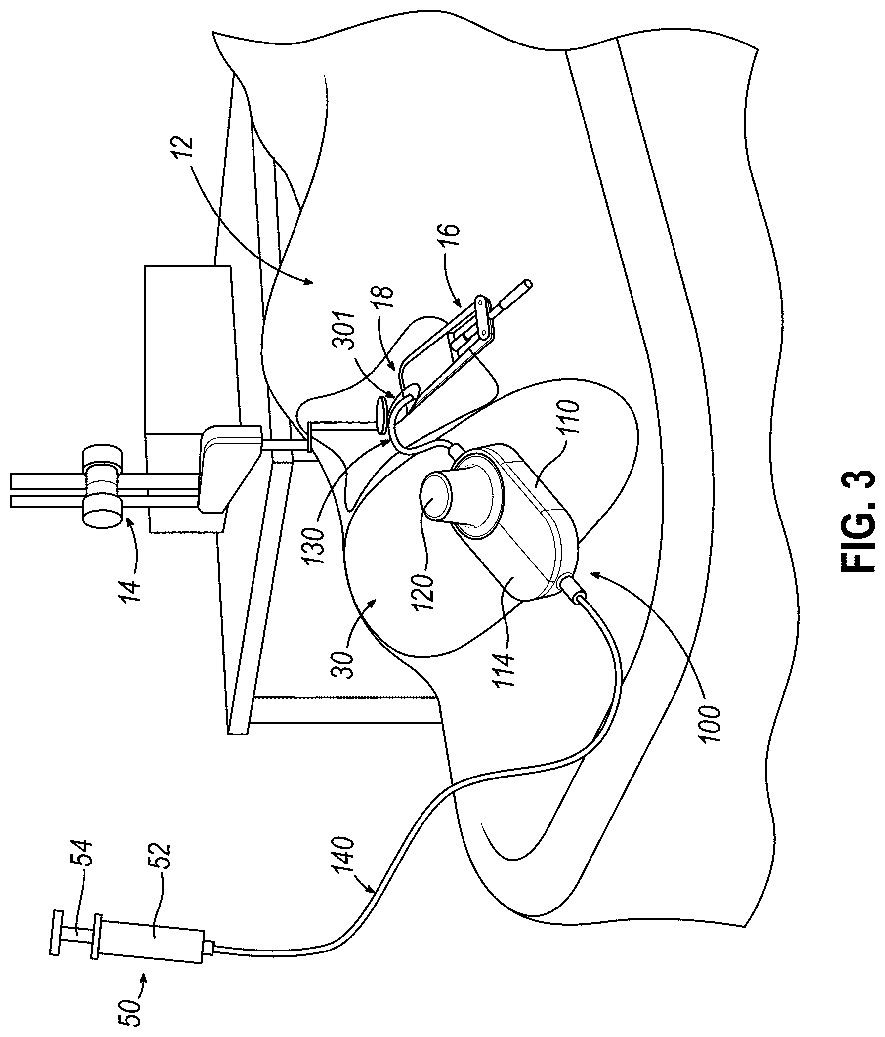 Patent US11771834 Figure 3 – Dose clip assembly for syringe