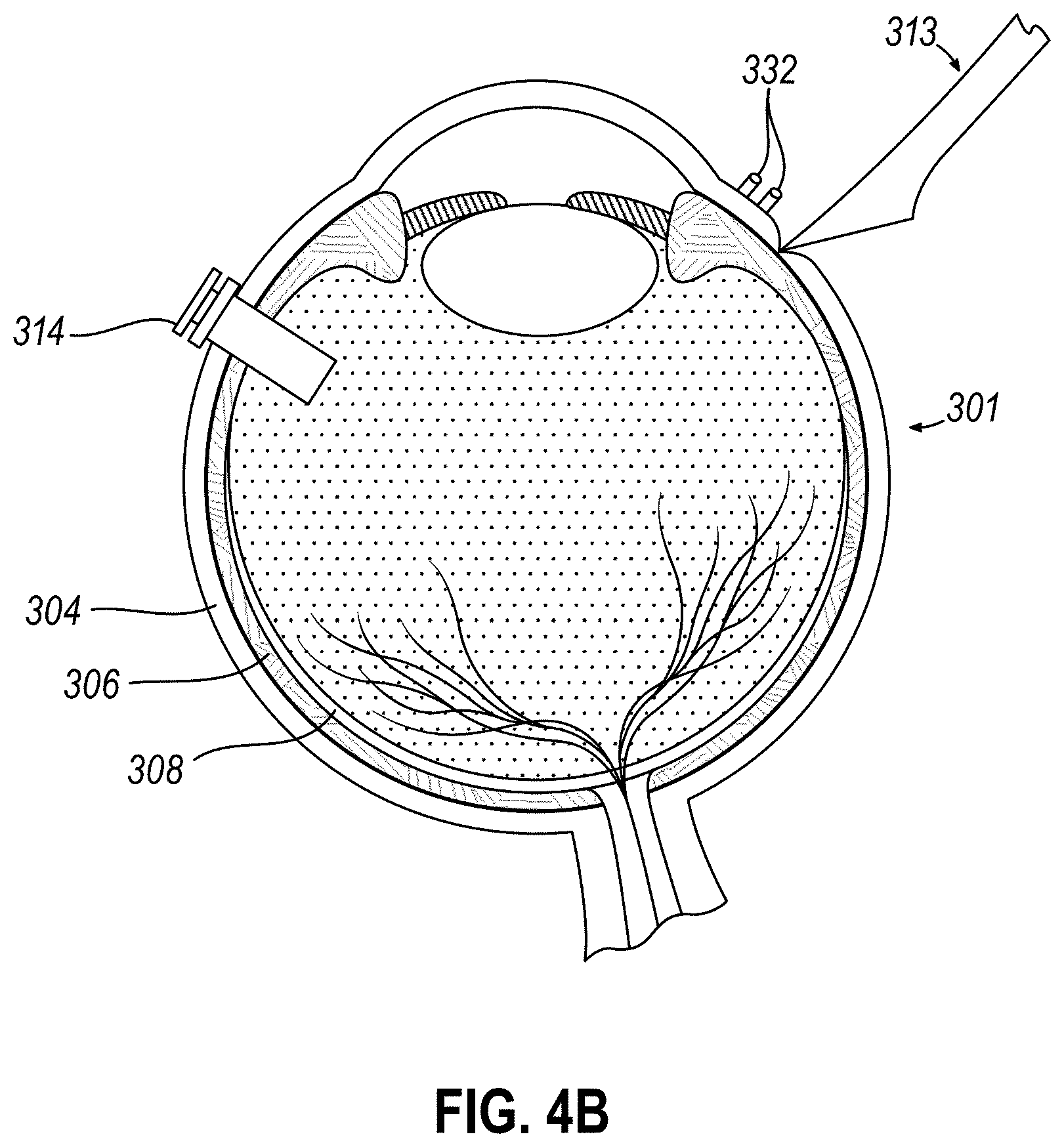 Patent US11771834 Figure 5 – Dose clip assembly for syringe