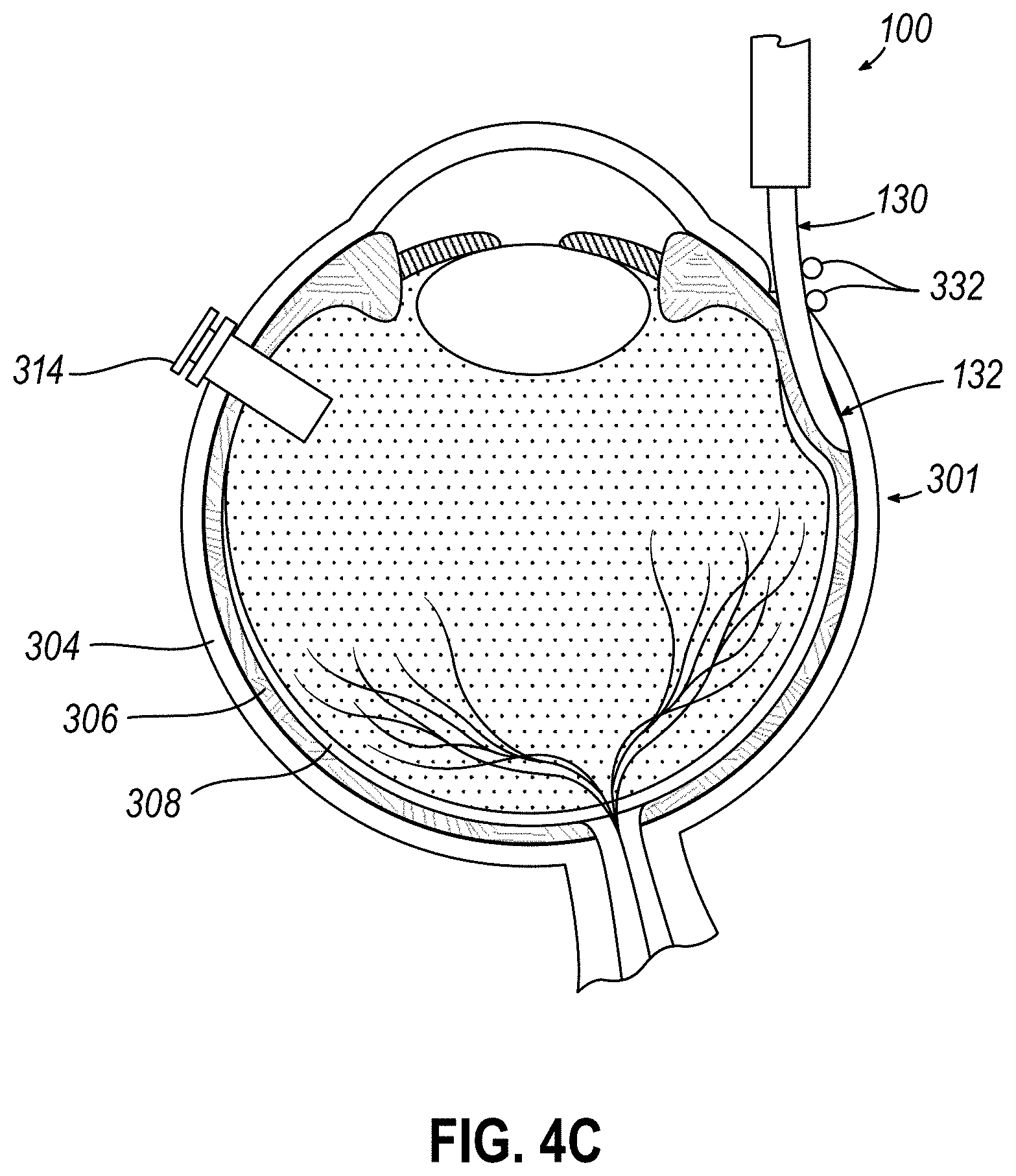 Patent US11771834 Figure 6 – Dose clip assembly for syringe