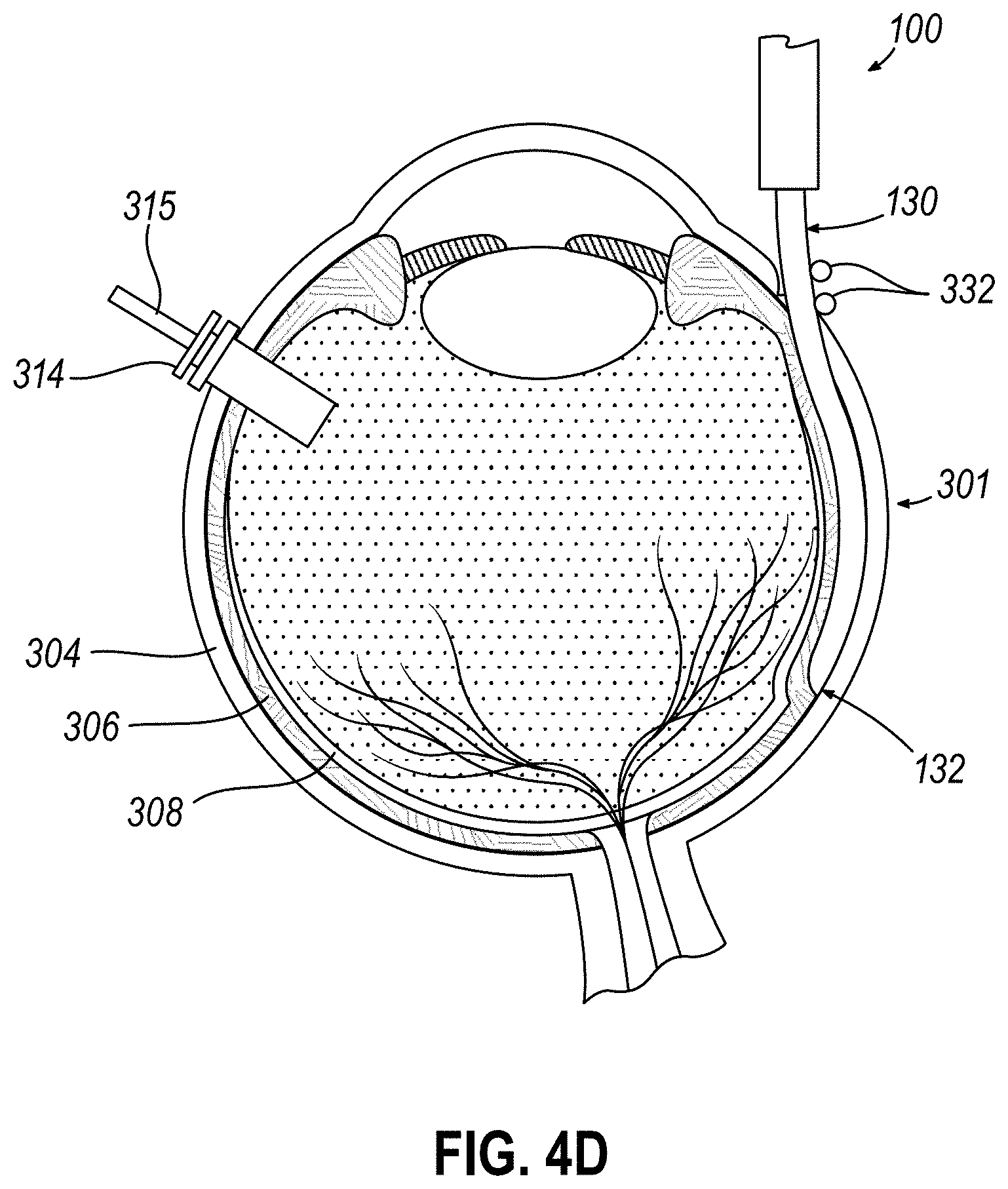 Patent US11771834 Figure 7 – Dose clip assembly for syringe