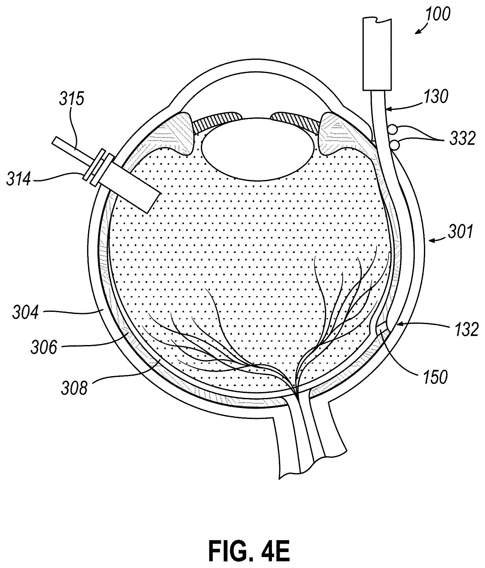 Patent US11771834 Figure 8 – Dose clip assembly for syringe