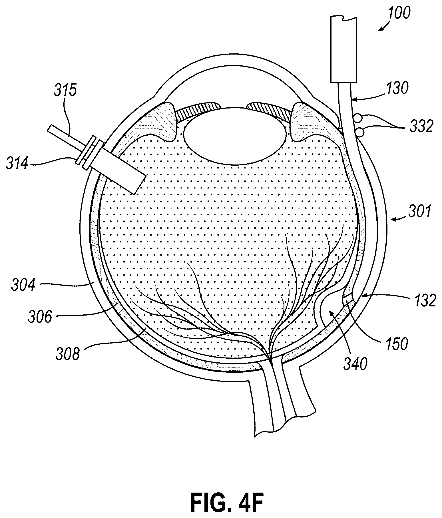 Patent US11771834 Figure 9 – Dose clip assembly for syringe