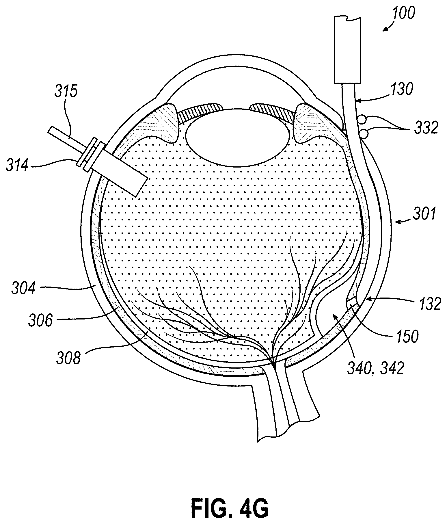 Patent US11771834 Figure 10 – Dose clip assembly for syringe