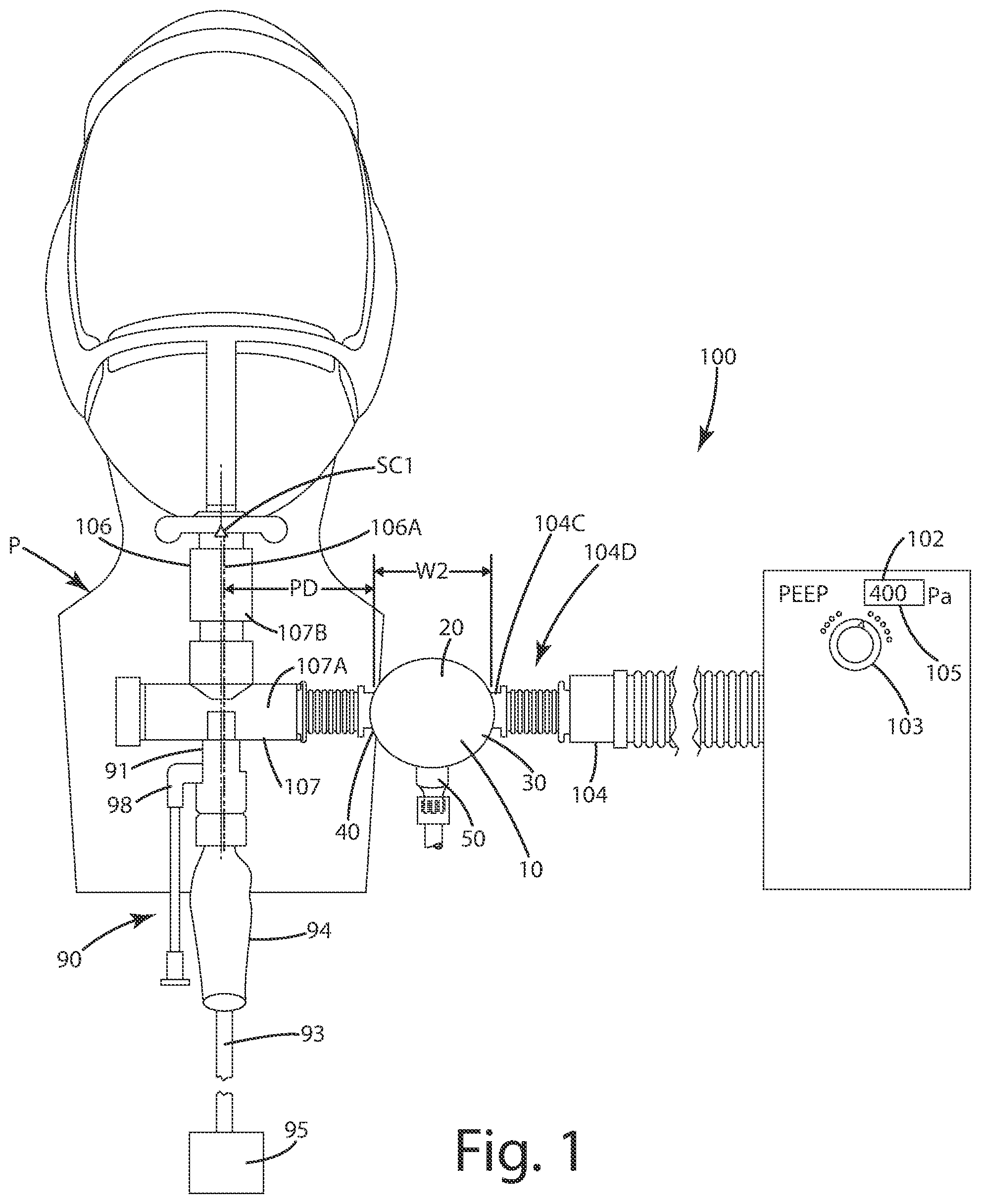 Patent US11771859 Figure 1 – Liquid removal apparatus for a breathing circuit and related method of use