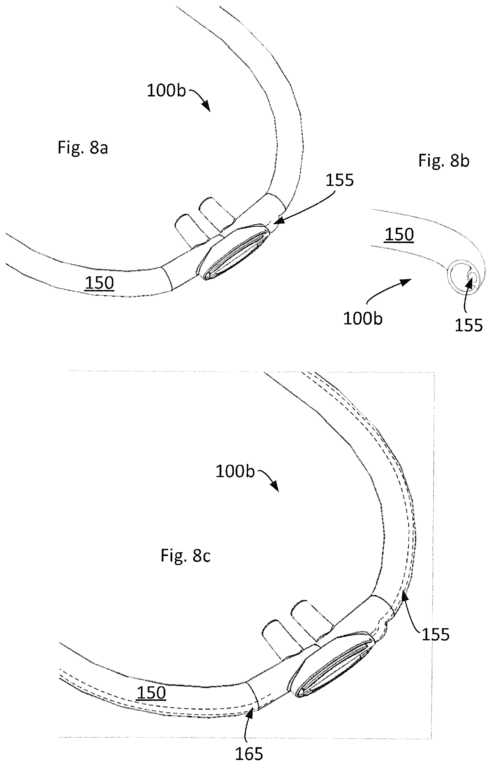 Patent US11771860 Figure 4 – Nasal patient interface arrangement, breathing apparatus, and method for operating a breathing apparatus