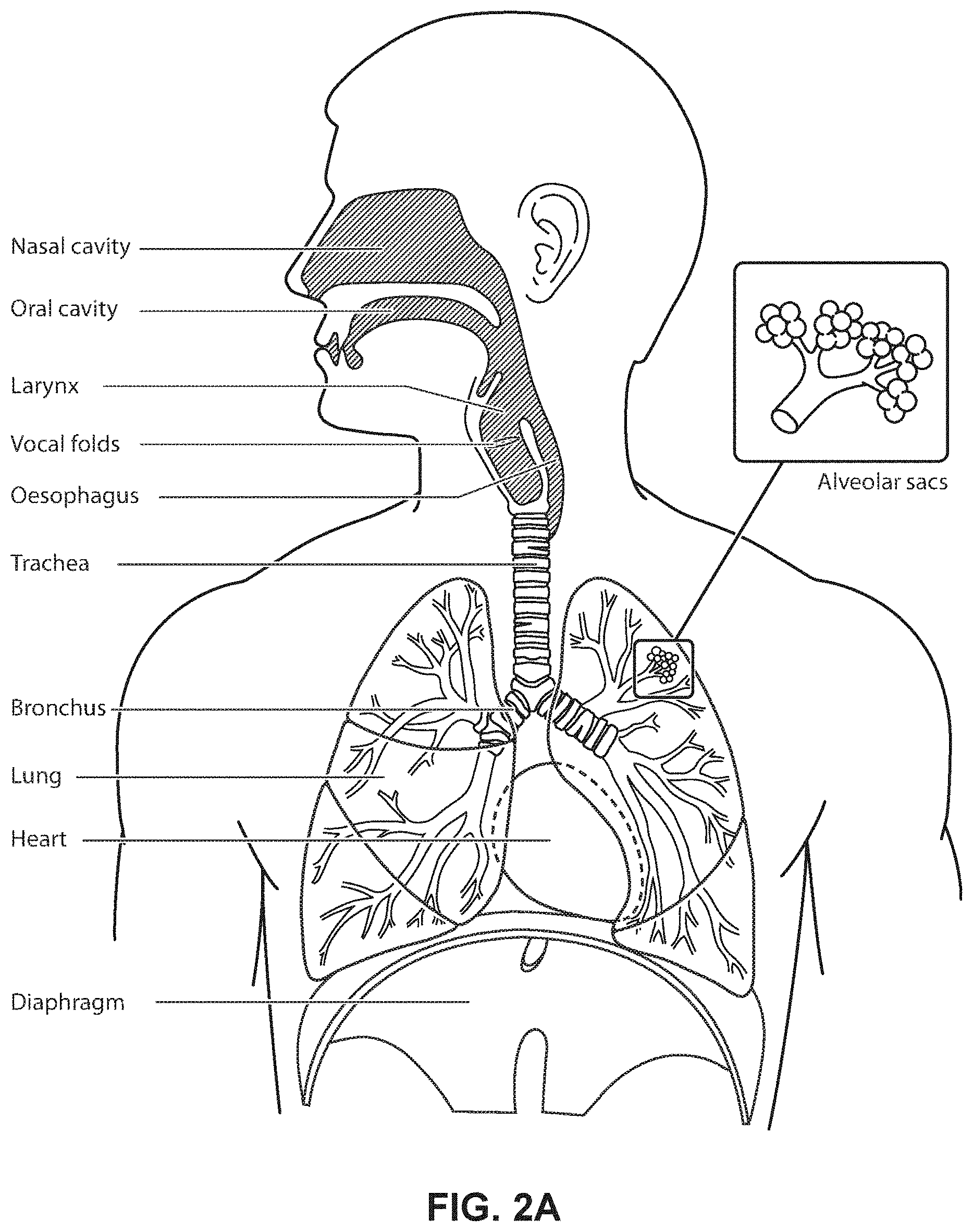 Patent US11771862 Figure 4 – Patient interface