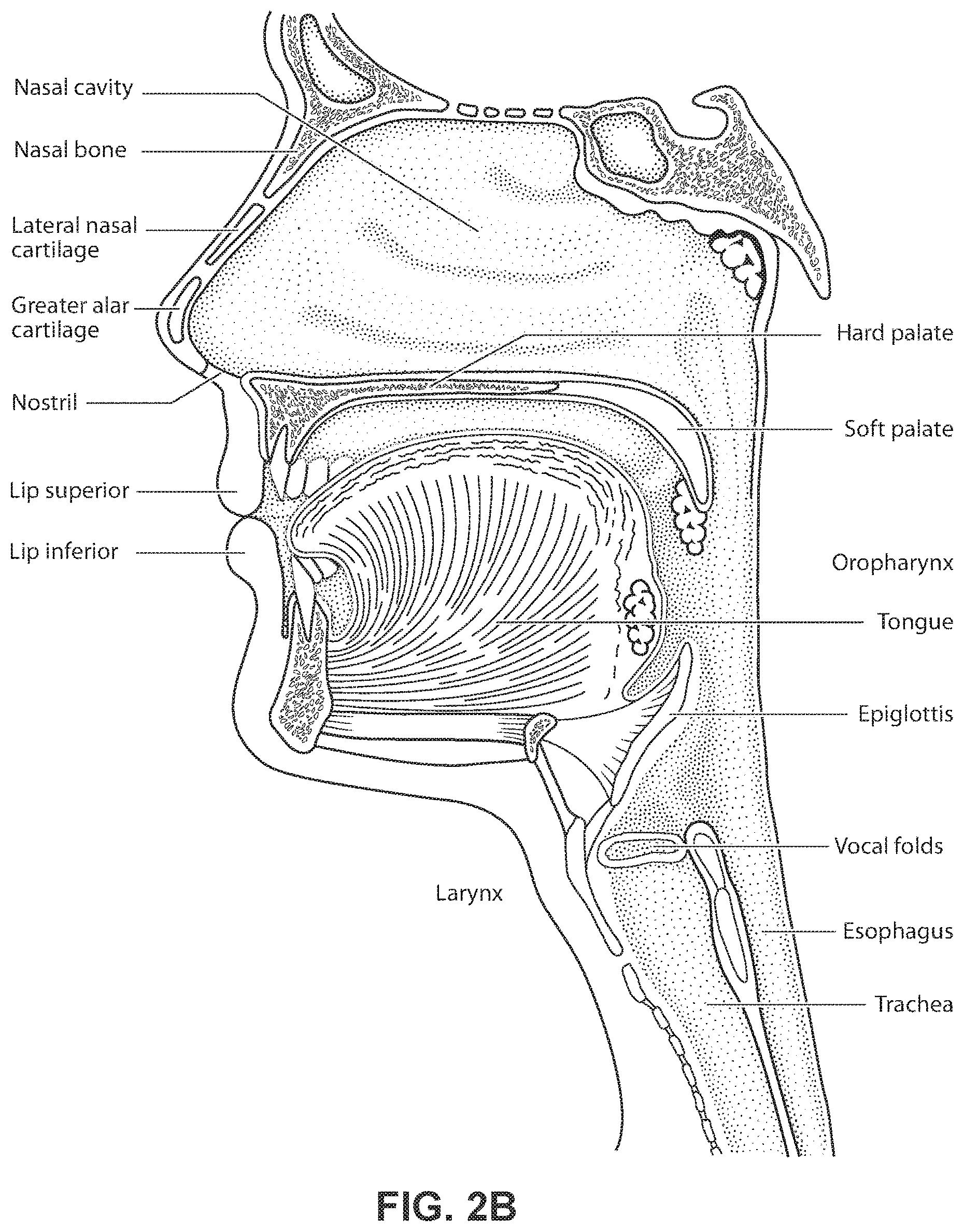 Patent US11771862 Figure 5 – Patient interface