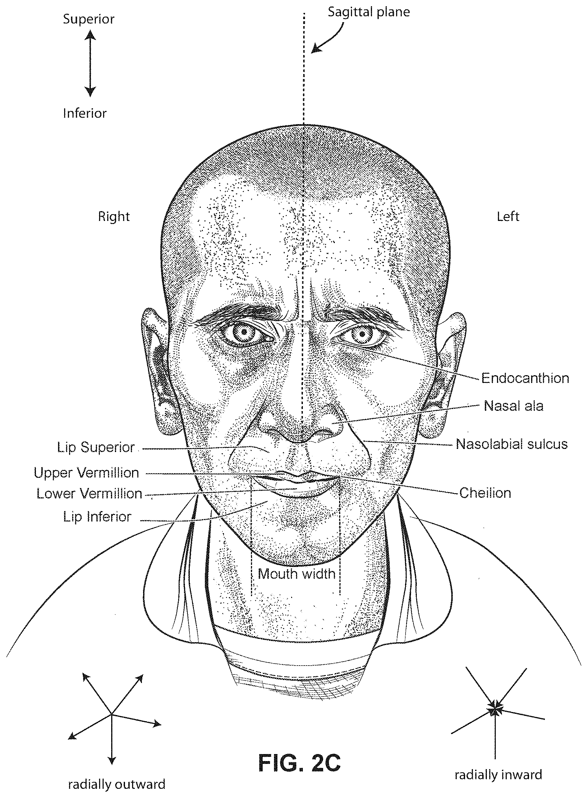 Patent US11771862 Figure 6 – Patient interface