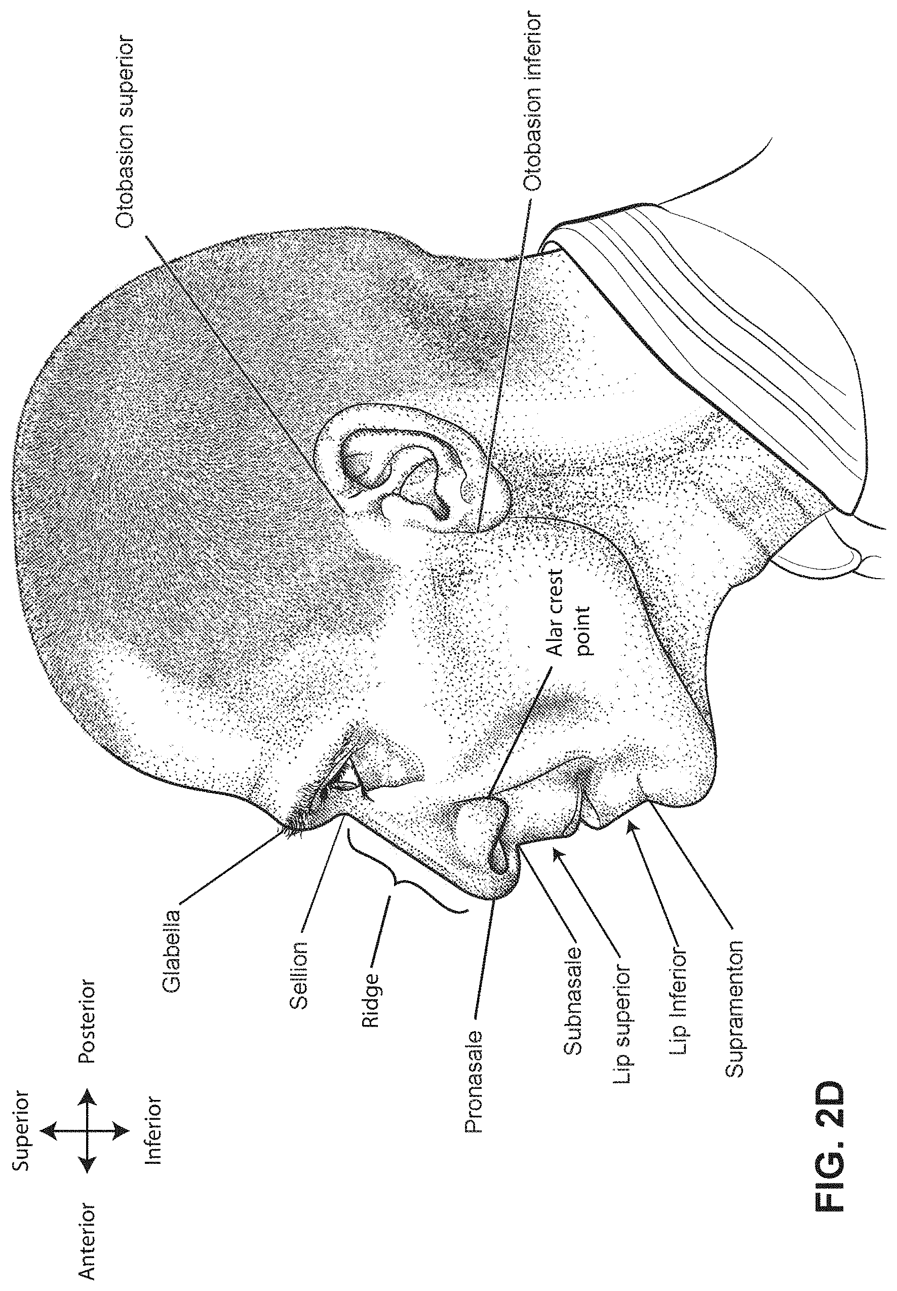 Patent US11771862 Figure 7 – Patient interface
