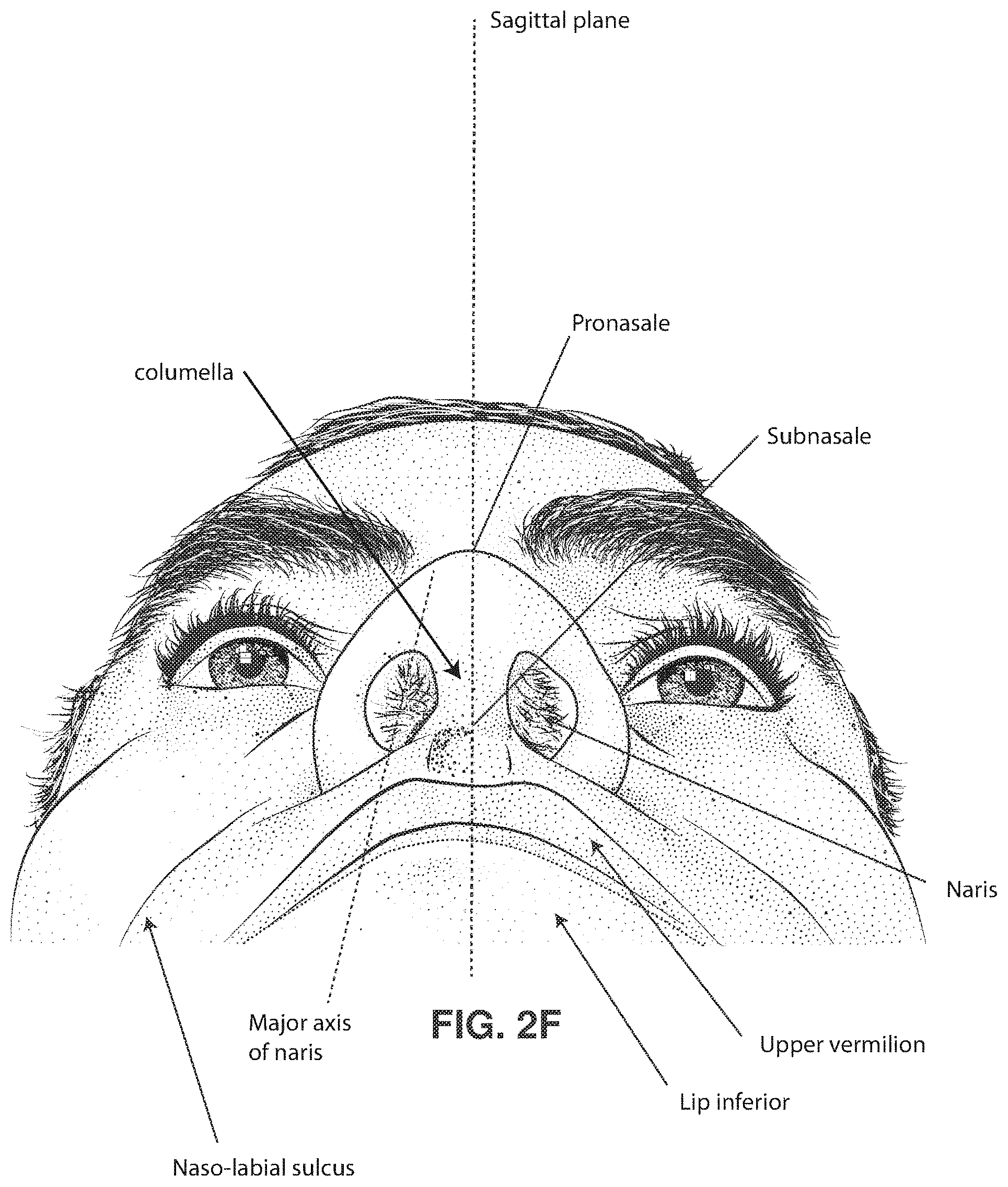 Patent US11771862 Figure 9 – Patient interface
