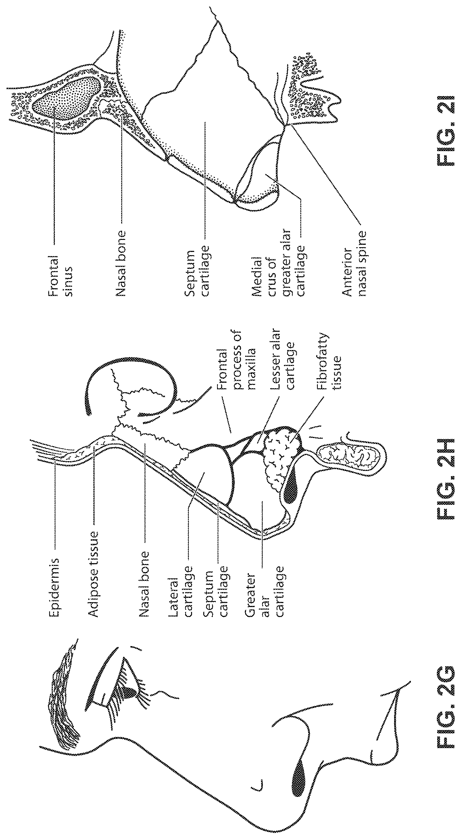 Patent US11771862 Figure 10 – Patient interface