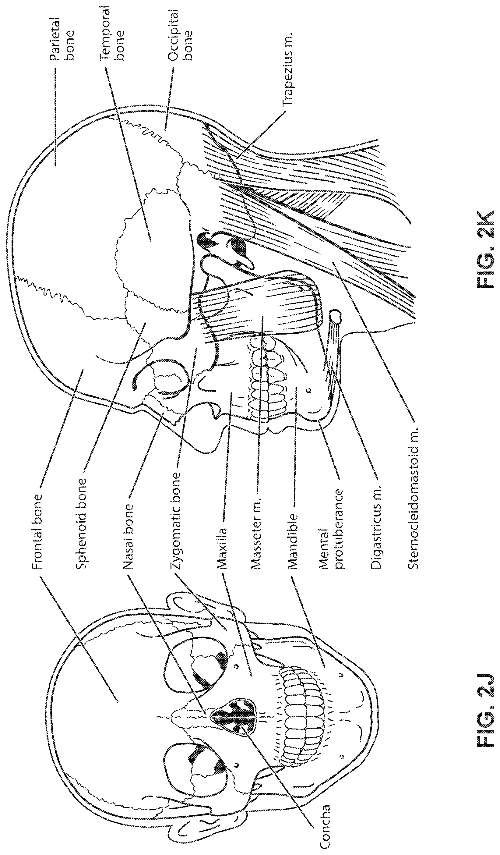 Patent US11771862 Figure 11 – Patient interface