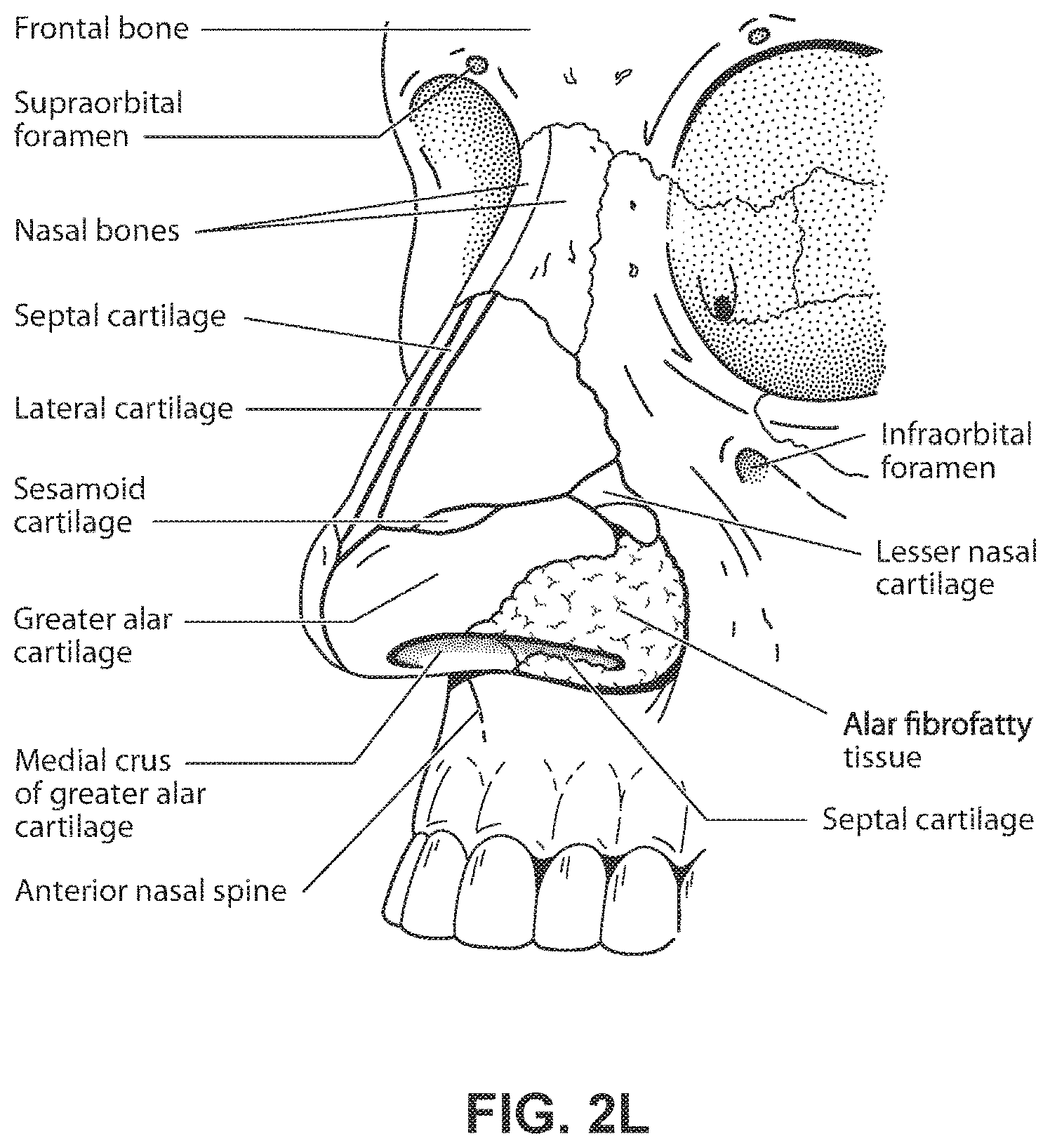 Patent US11771862 Figure 12 – Patient interface