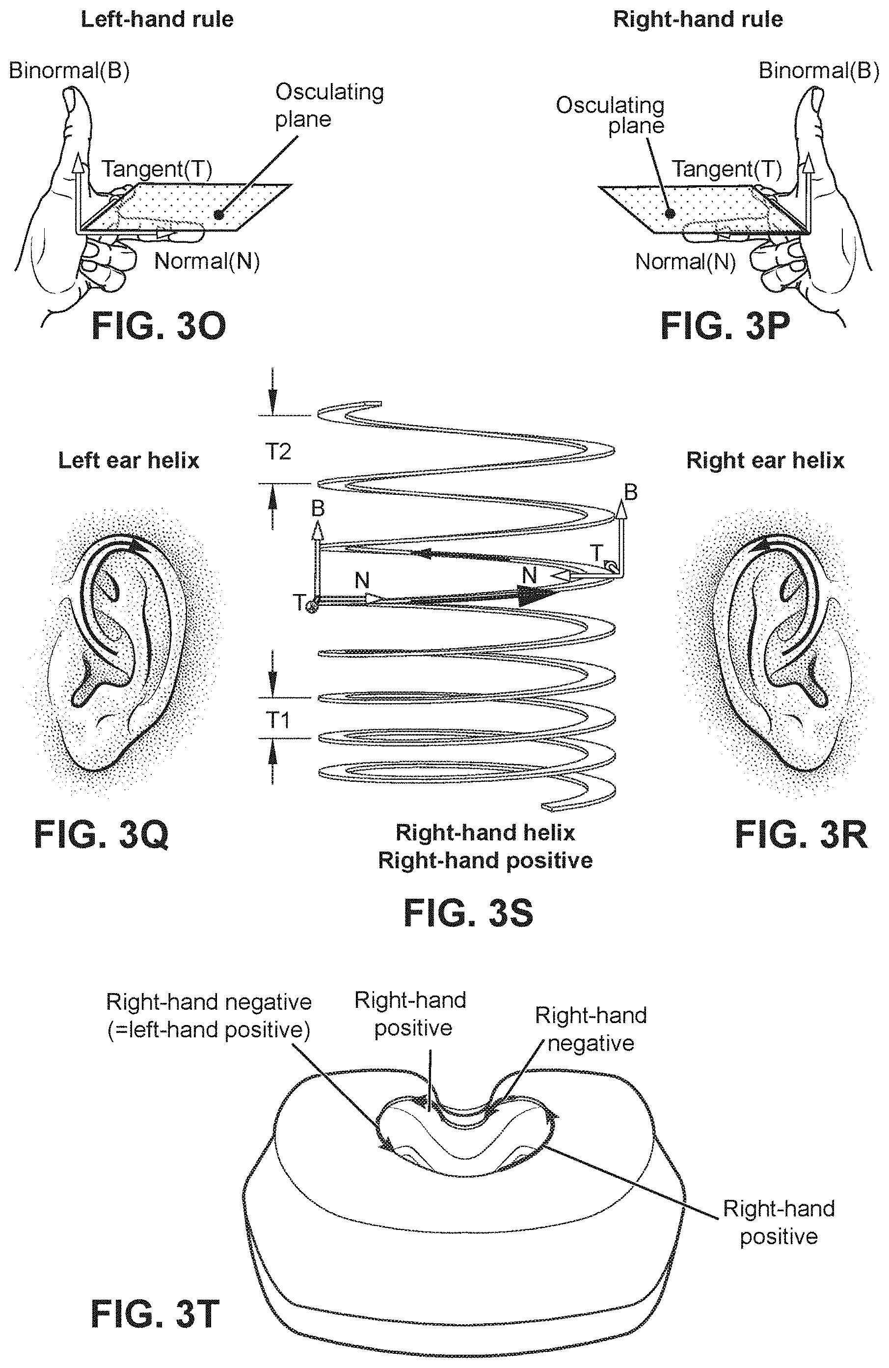 Patent US11771862 Figure 17 – Patient interface
