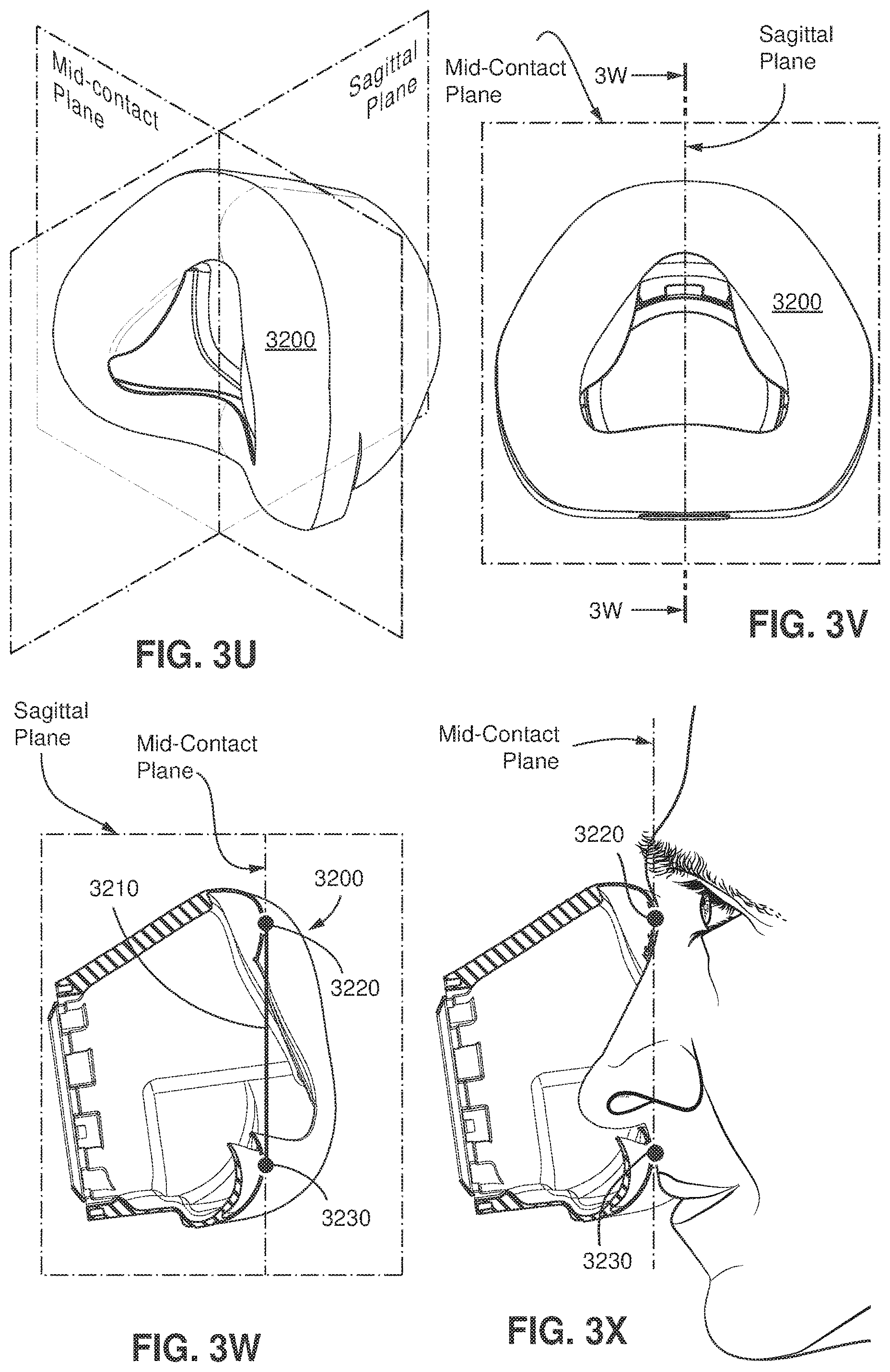 Patent US11771862 Figure 18 – Patient interface