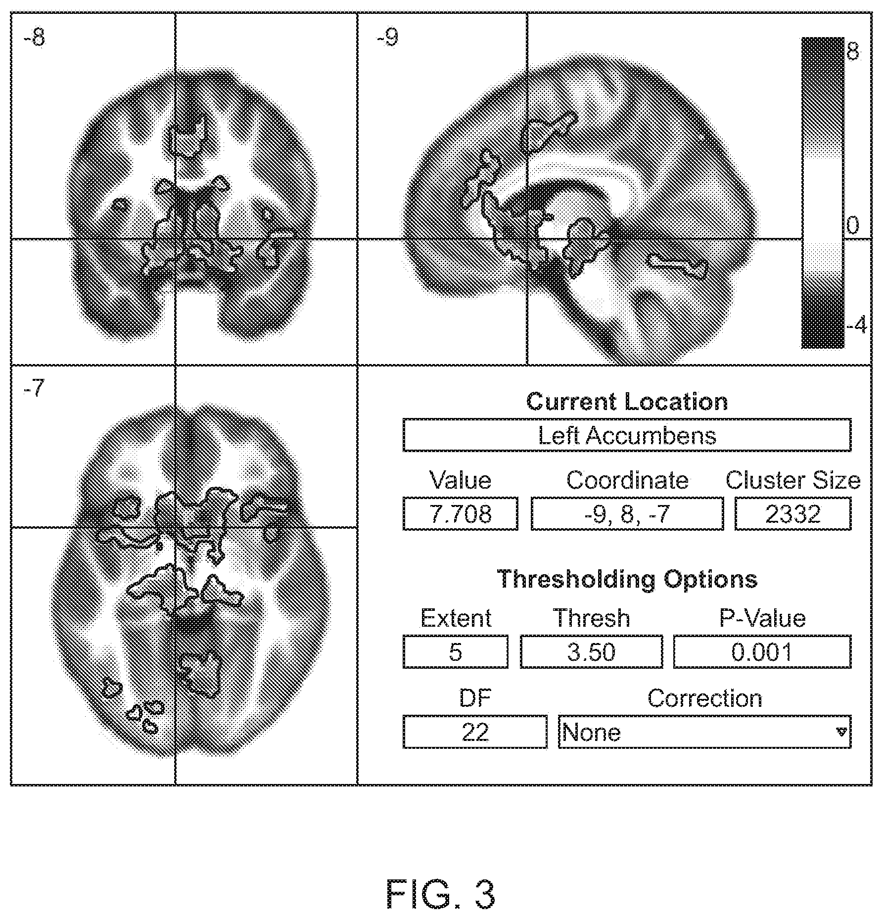 Patent US11771864 Figure 3 – Devices, systems and methods for delivering coffee-derived volatiles