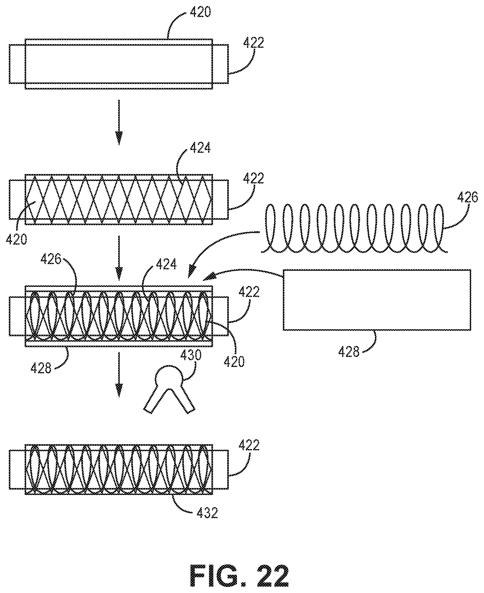 Patent US11771867 Figure 6 – Suction catheter systems for applying effective aspiration in remote vessels, especially cerebral arteries