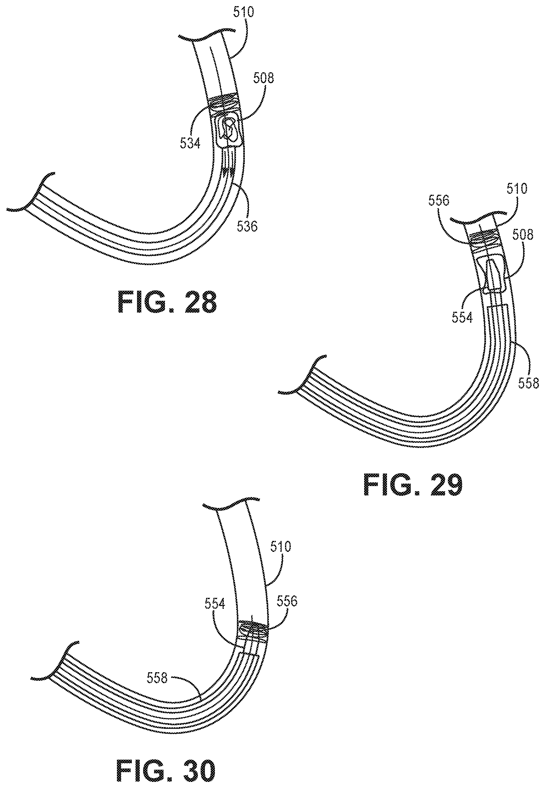 Patent US11771867 Figure 9 – Suction catheter systems for applying effective aspiration in remote vessels, especially cerebral arteries