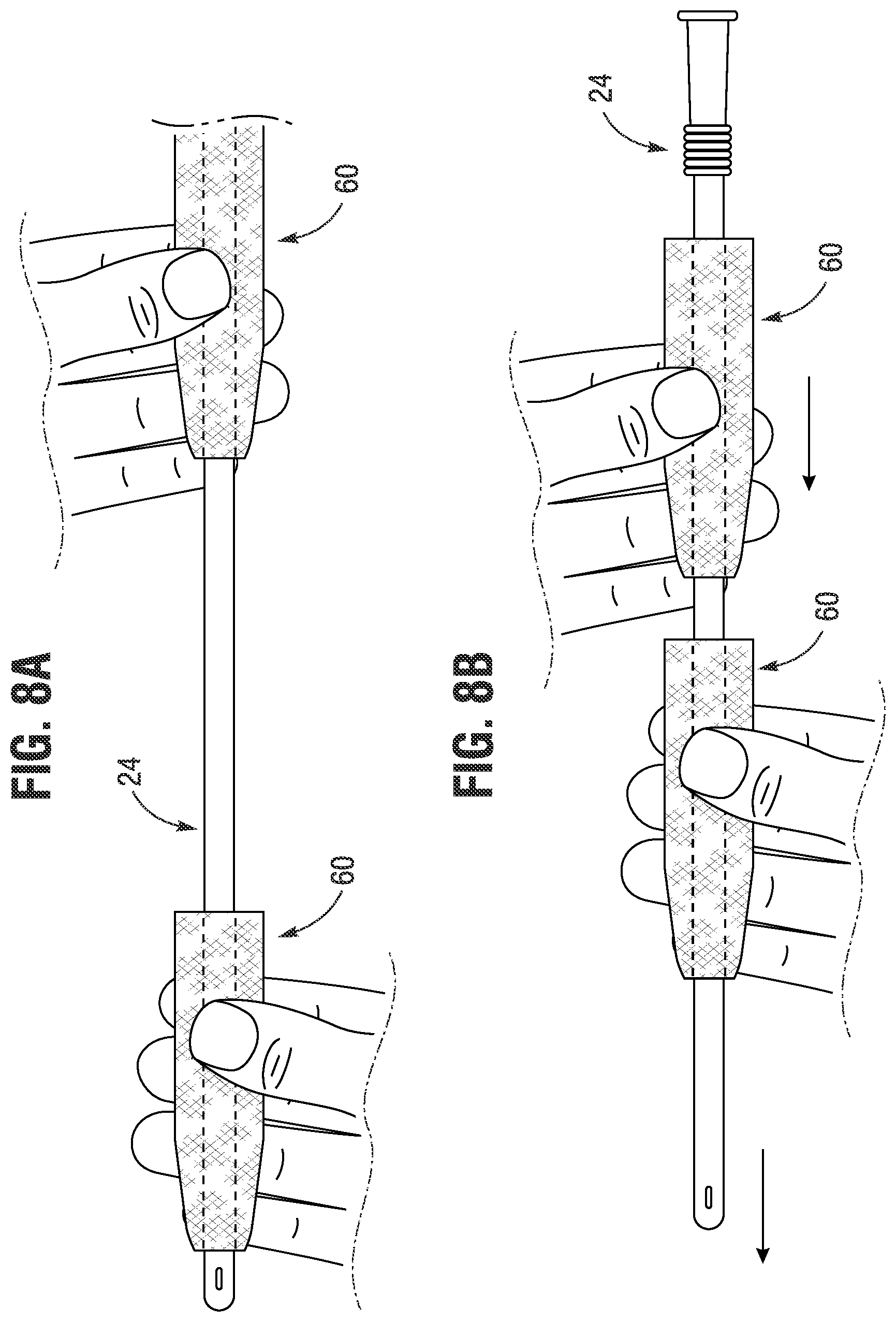 Patent US11771868 Figure 6 – Gripper sleeve for urinary catheter