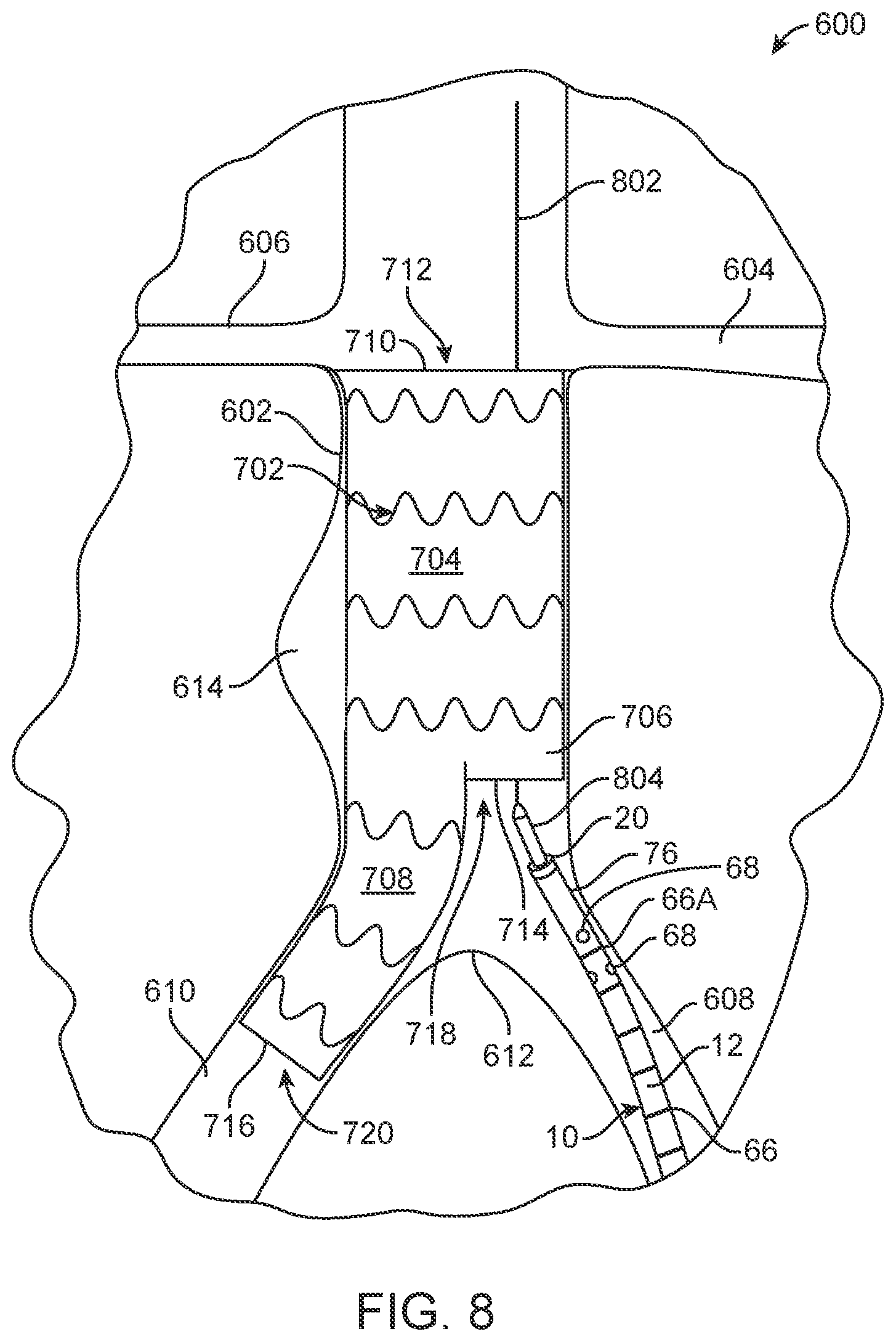 Patent US11771870 Figure 5 – Vector flush sizing catheter and method