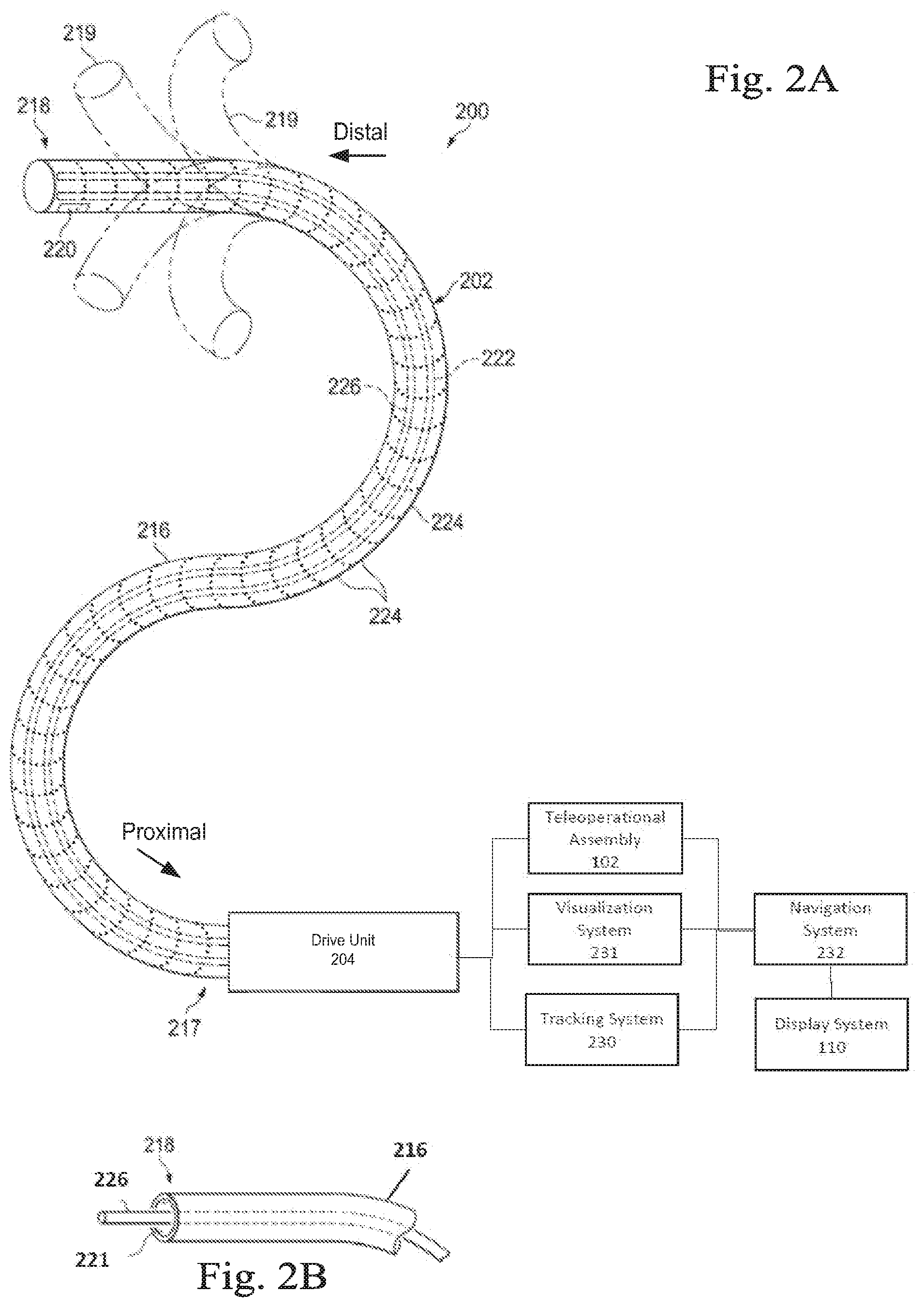 Patent US11771871 Figure 2 – Axial support structure for a flexible elongate device