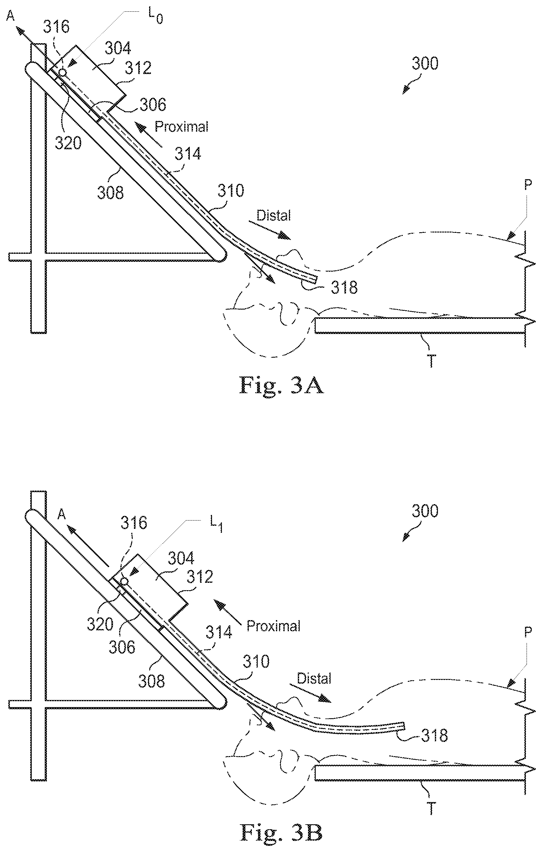 Patent US11771871 Figure 3 – Axial support structure for a flexible elongate device
