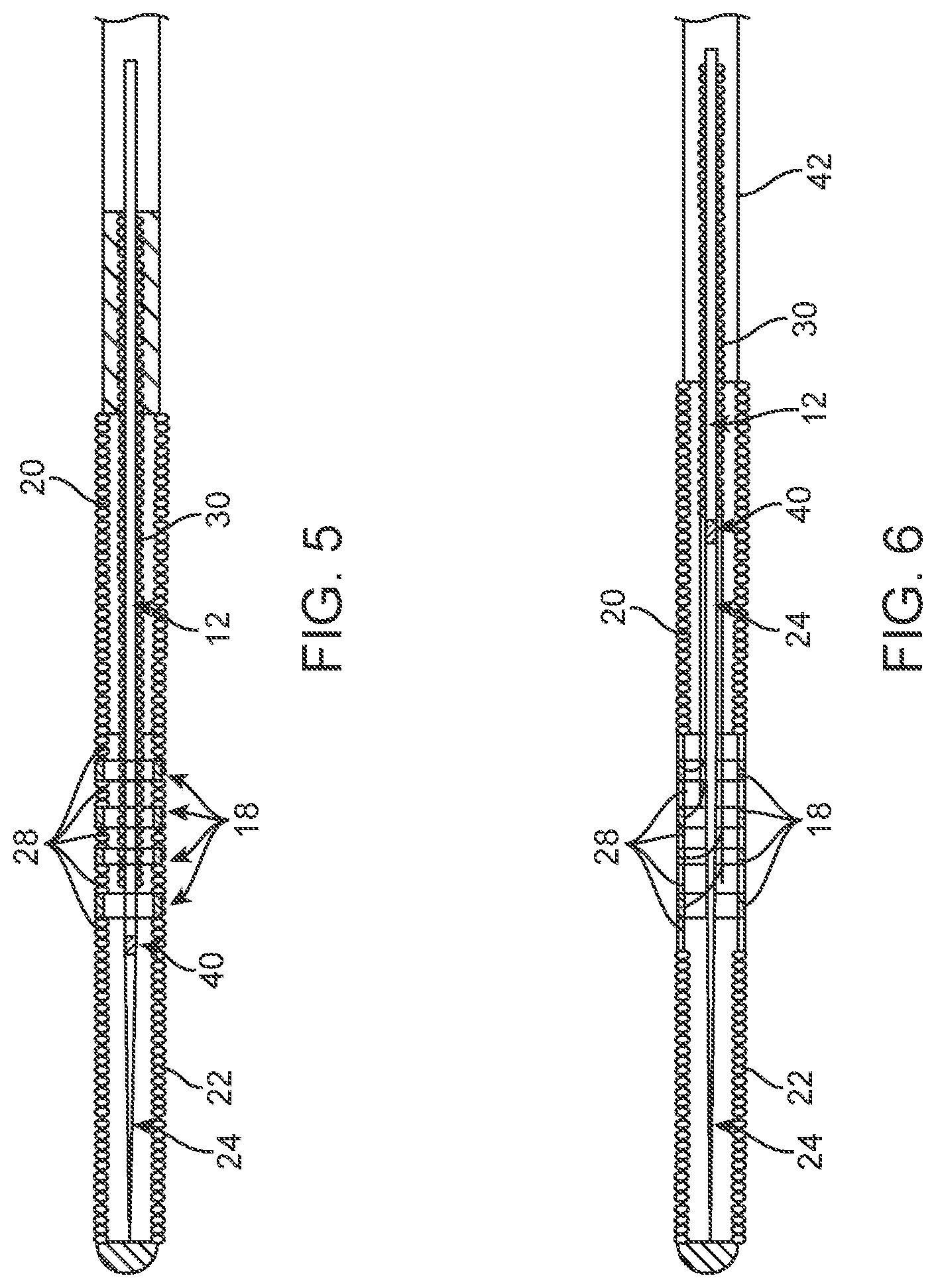 Patent US11771872 Figure 3 – Guidewire assembly