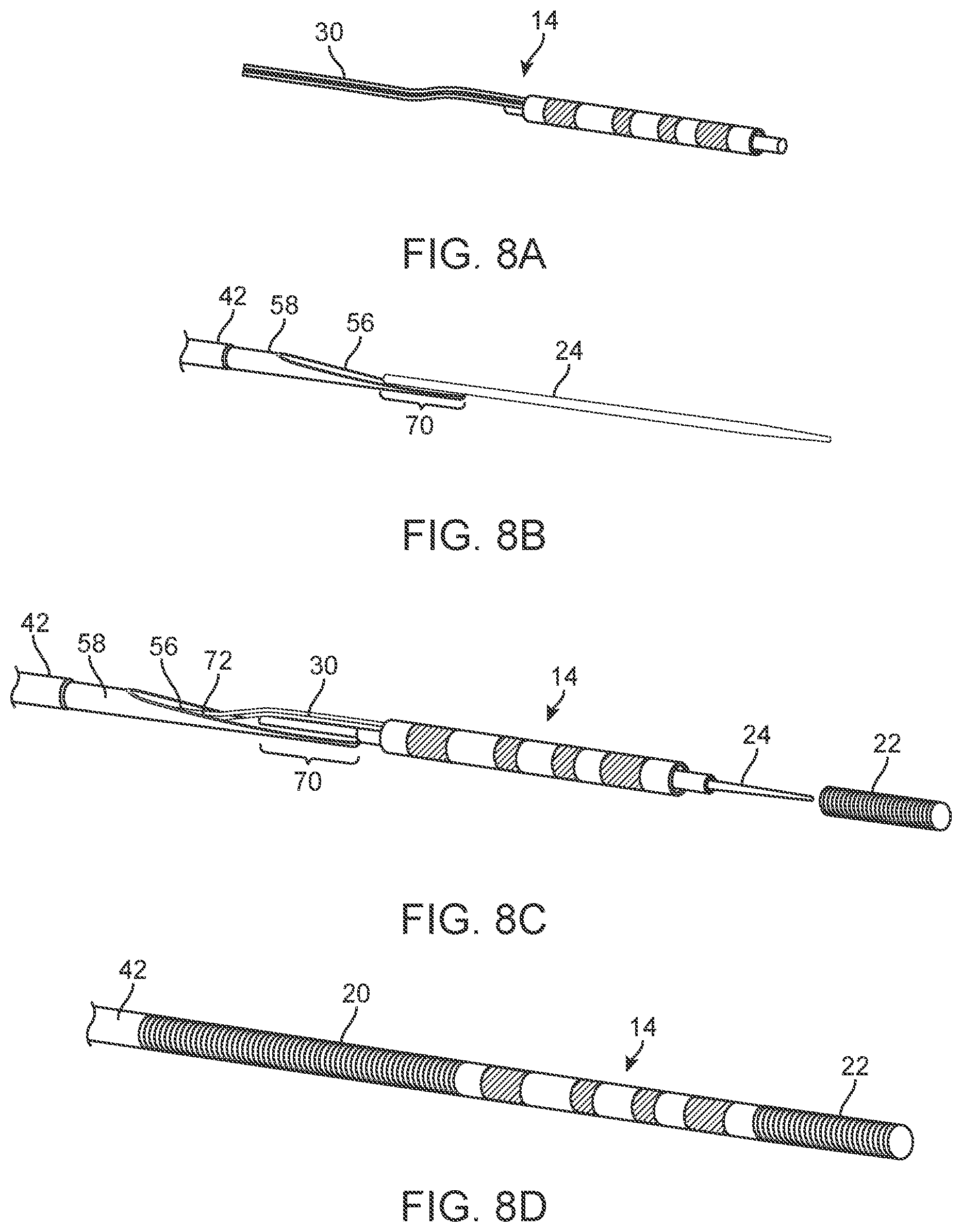 Patent US11771872 Figure 6 – Guidewire assembly