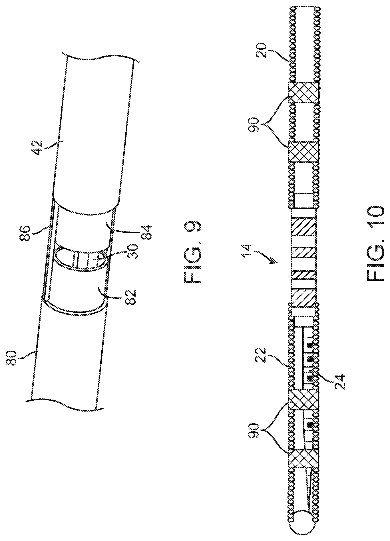 Patent US11771872 Figure 7 – Guidewire assembly