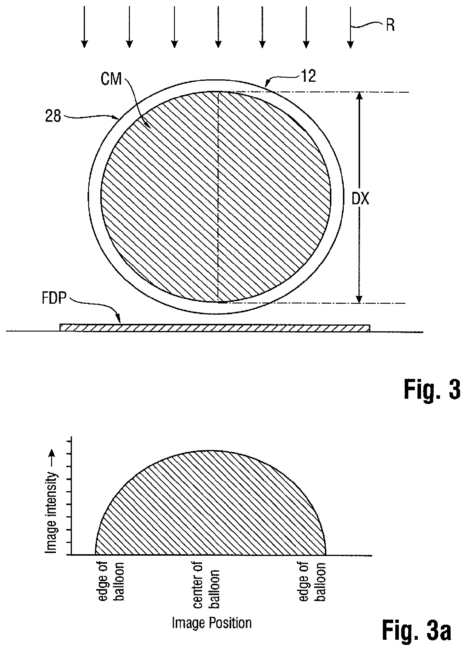 Patent US11771873 Figure 2 – Medical balloon with radiopaque identifier for precisely identifying the working surface
