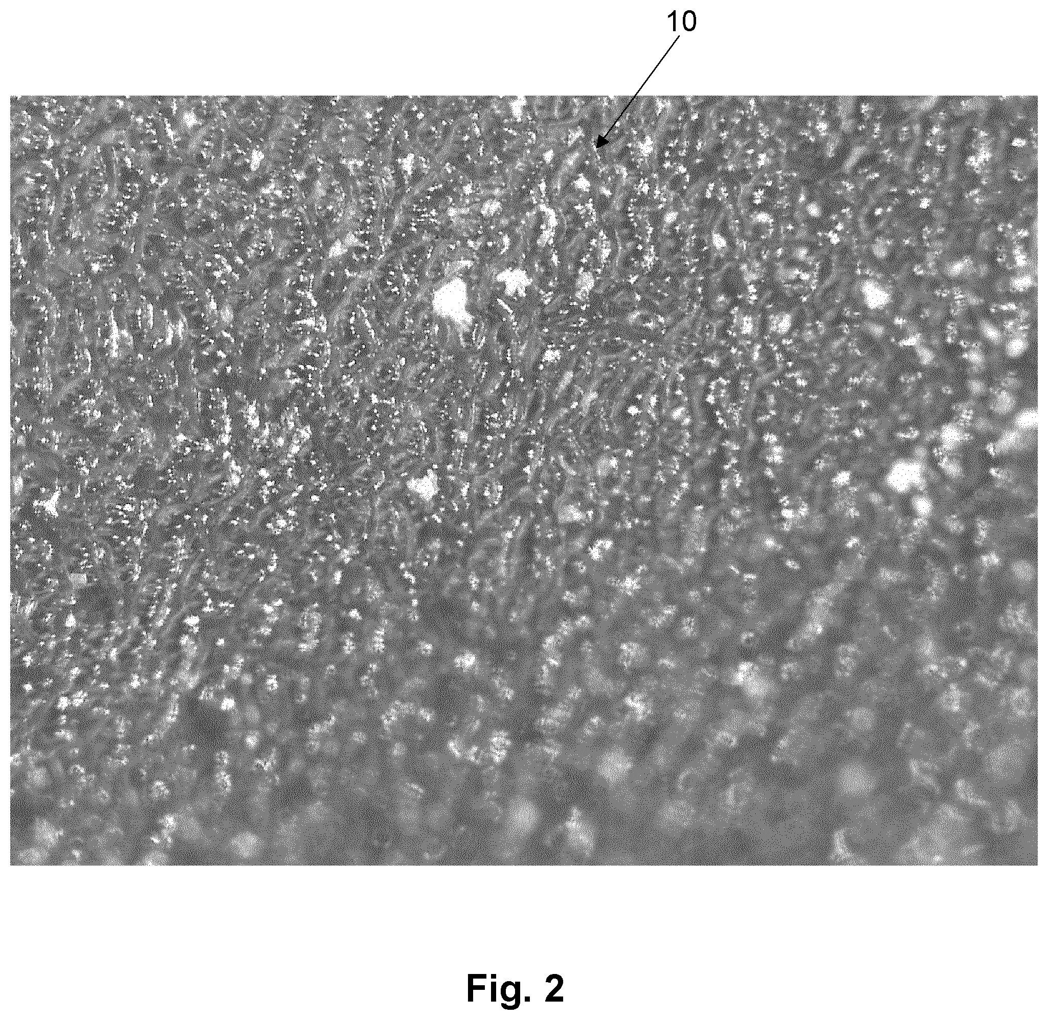 Patent US11771874 Figure 2 – Functionalized balloon surface