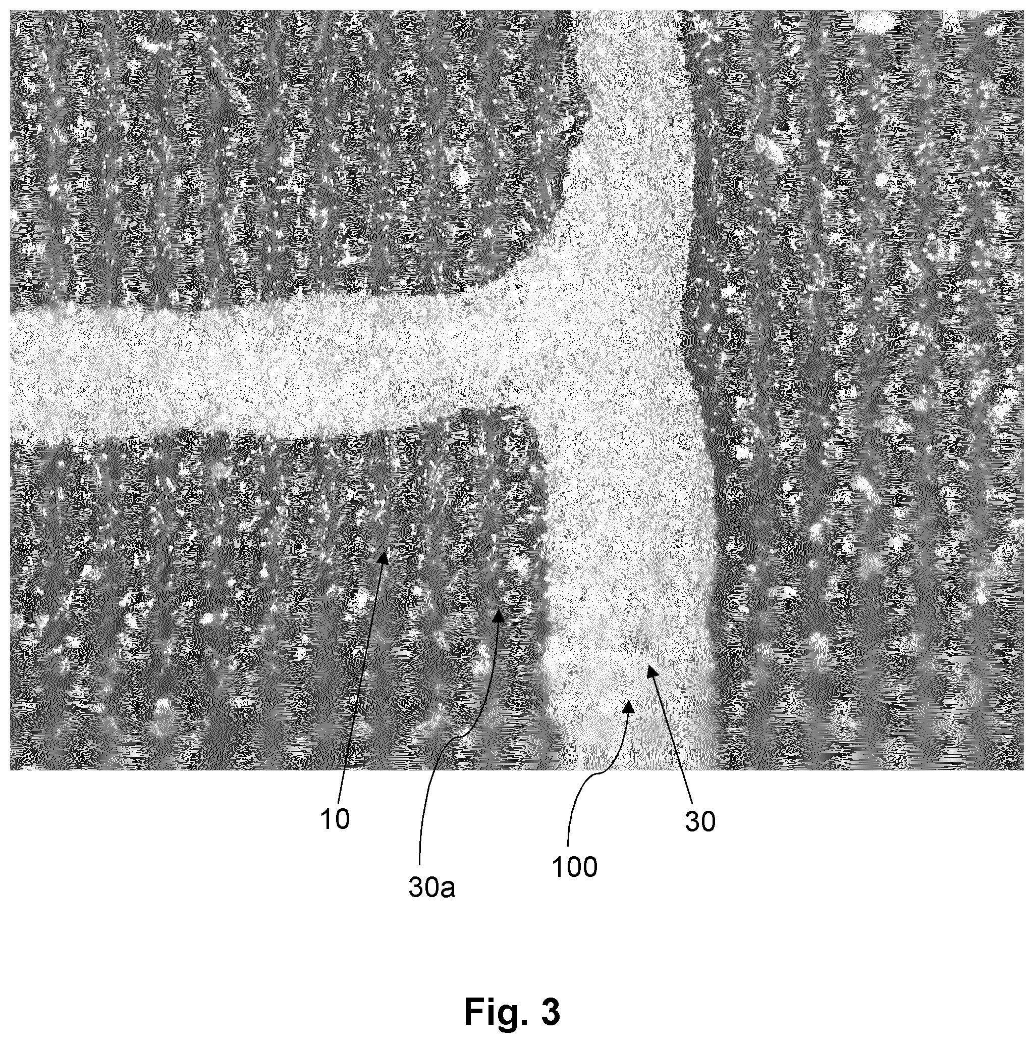 Patent US11771874 Figure 3 – Functionalized balloon surface