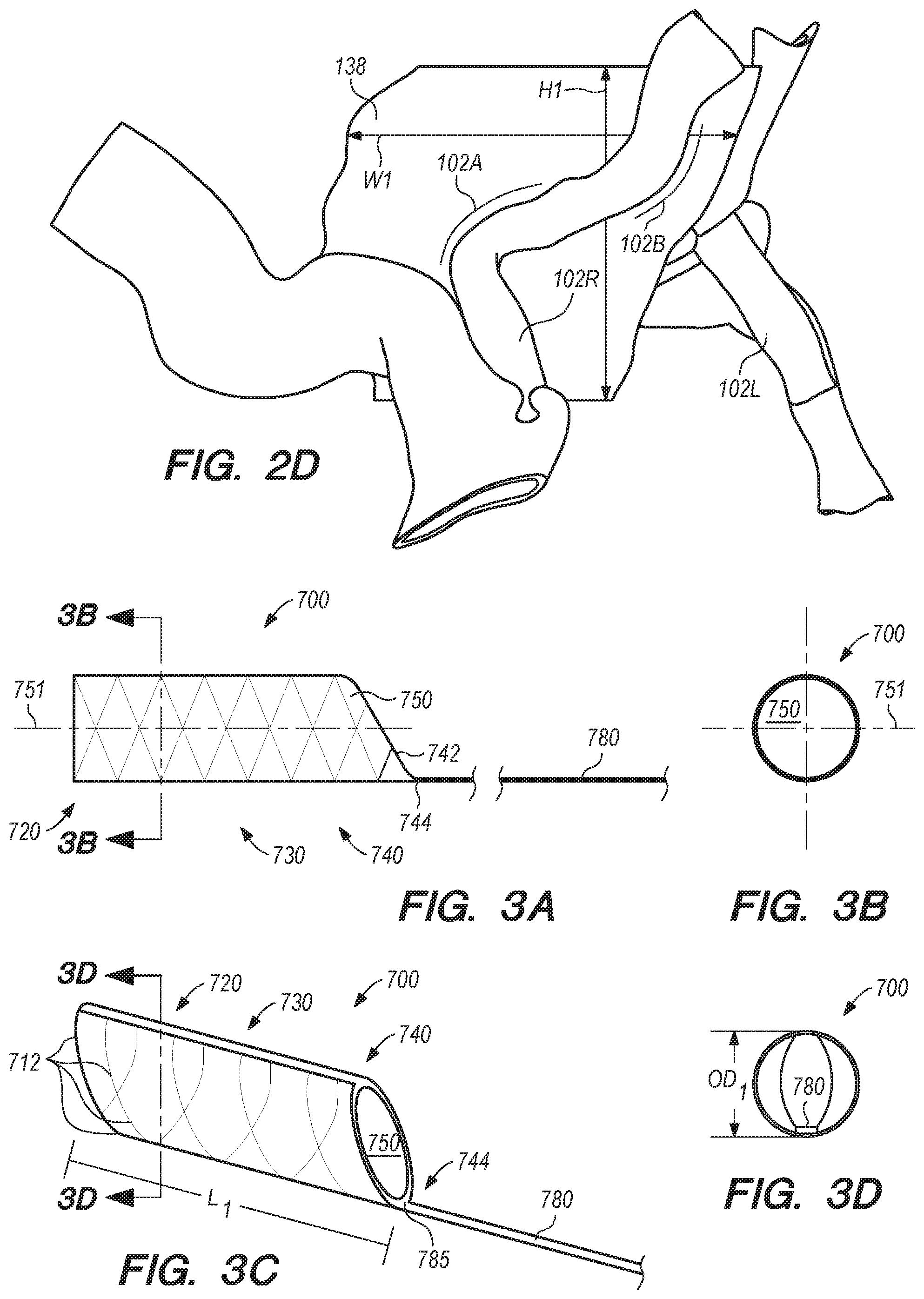 Patent US11771875 Figure 3 – Catheter systems and methods for medical procedures using catheters