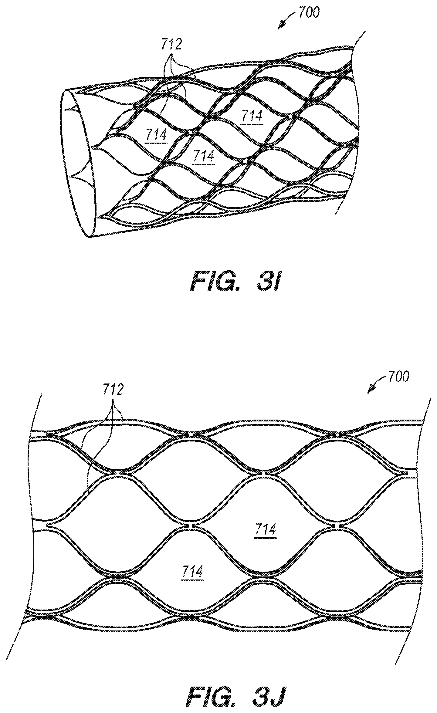 Patent US11771875 Figure 5 – Catheter systems and methods for medical procedures using catheters
