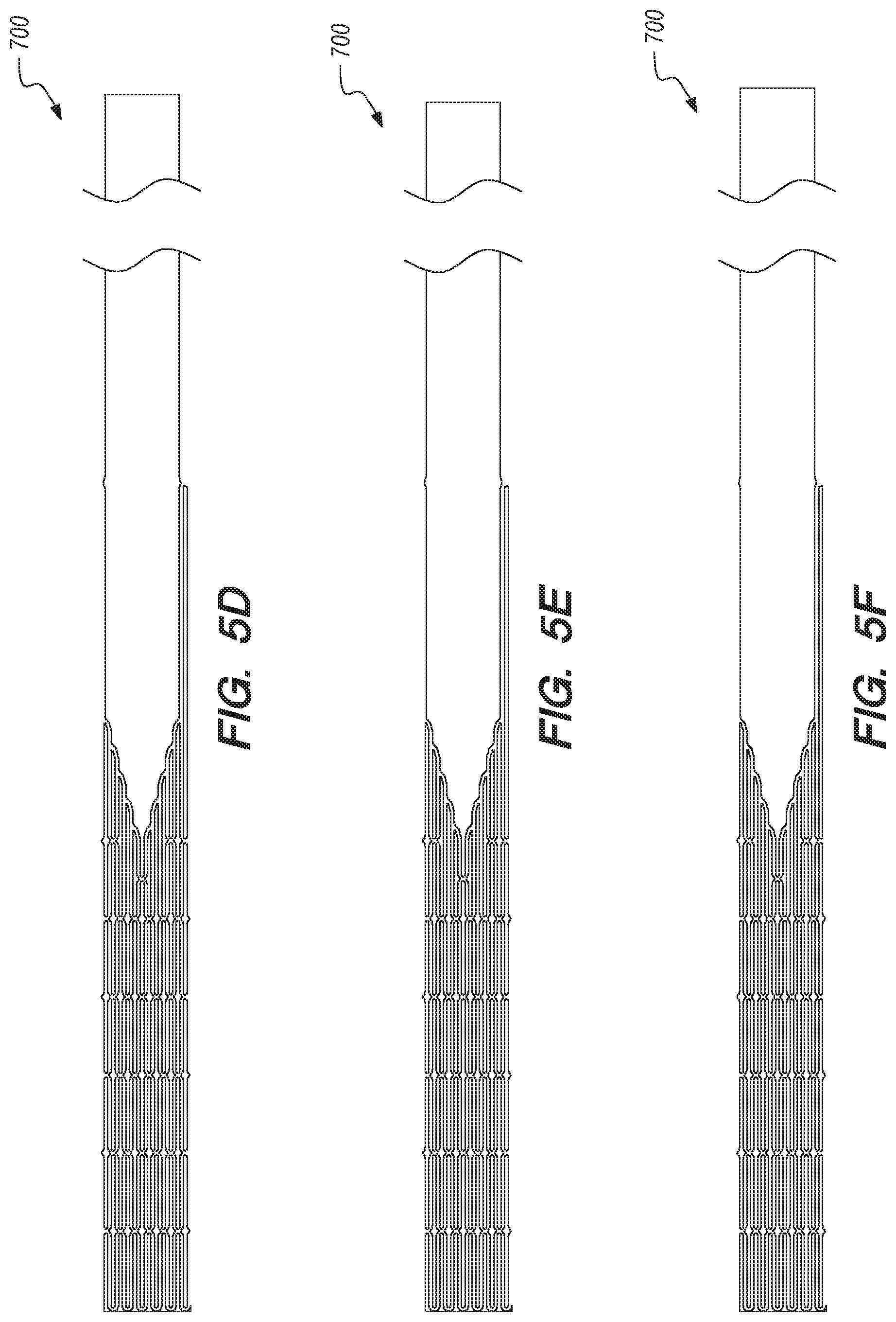 Patent US11771875 Figure 8 – Catheter systems and methods for medical procedures using catheters