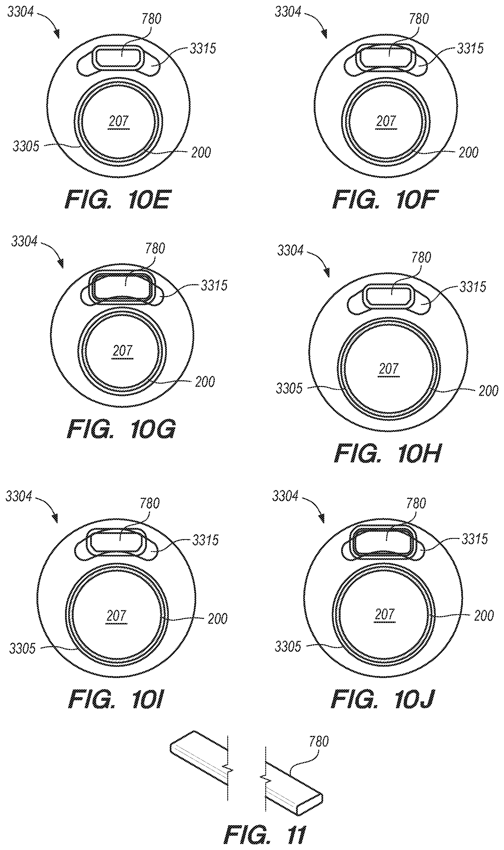 Patent US11771875 Figure 18 – Catheter systems and methods for medical procedures using catheters