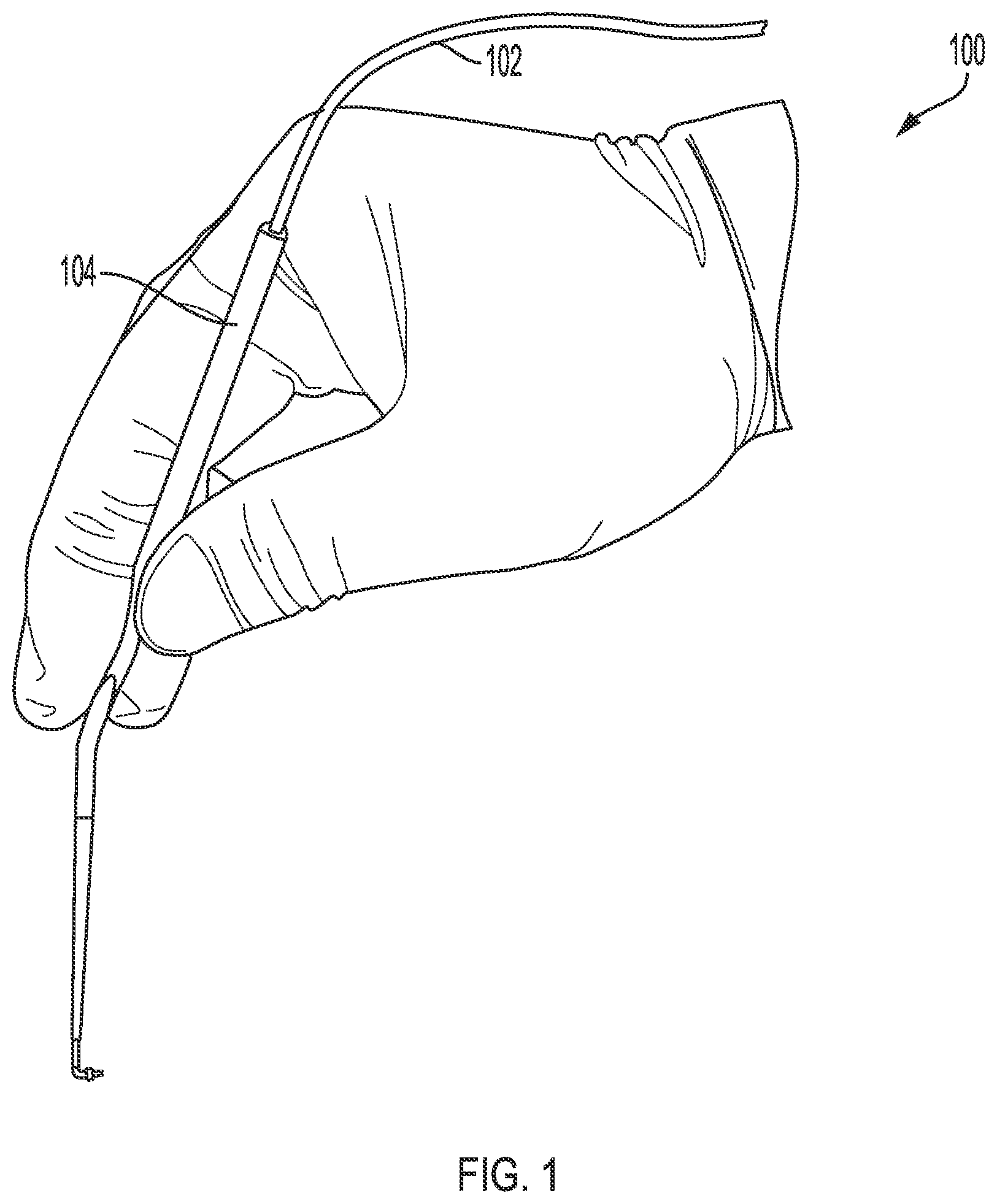 Patent US11771876 Figure 1 – System for inner ear drug delivery via trans-round window membrane injection