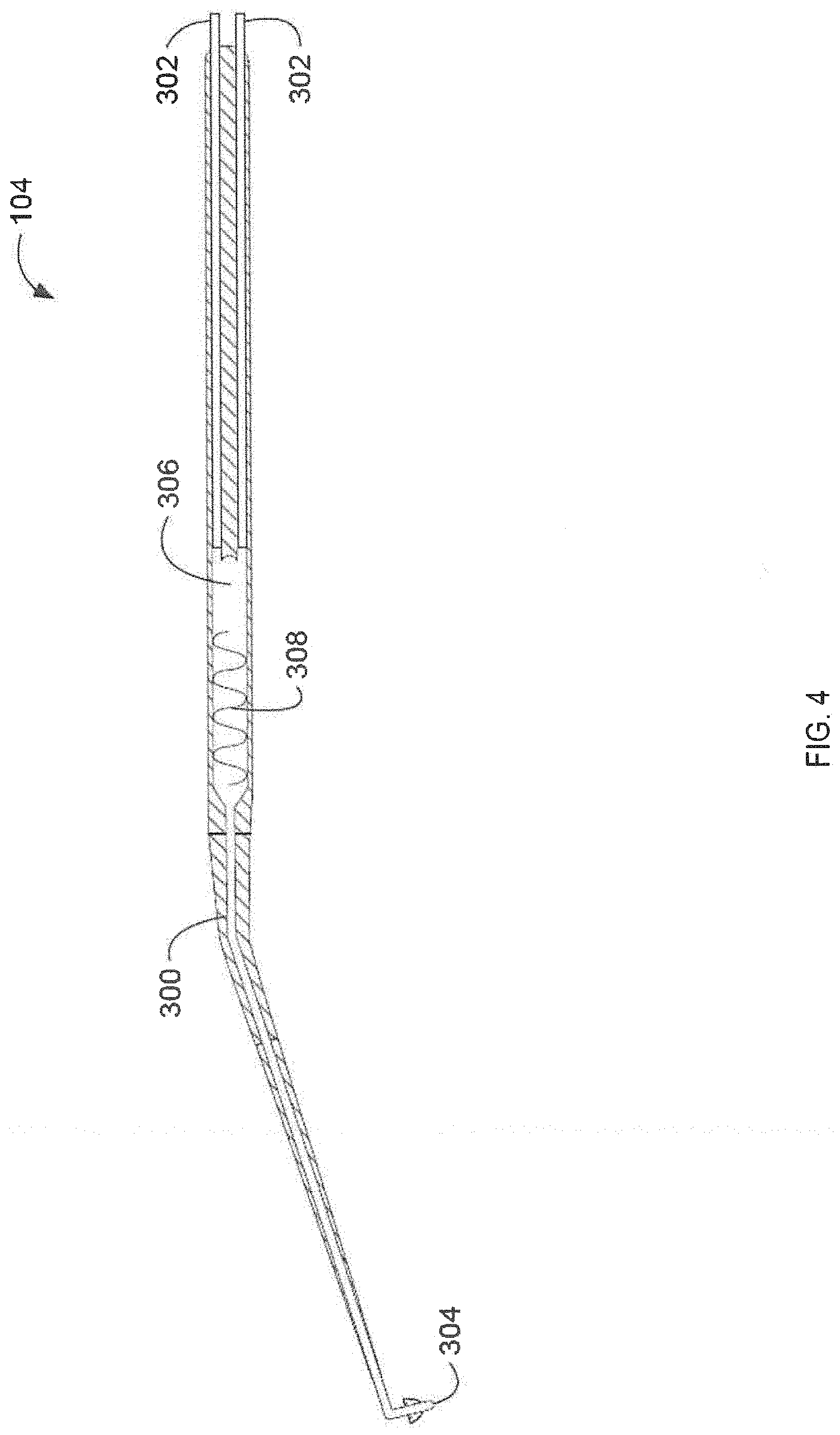 Patent US11771876 Figure 4 – System for inner ear drug delivery via trans-round window membrane injection
