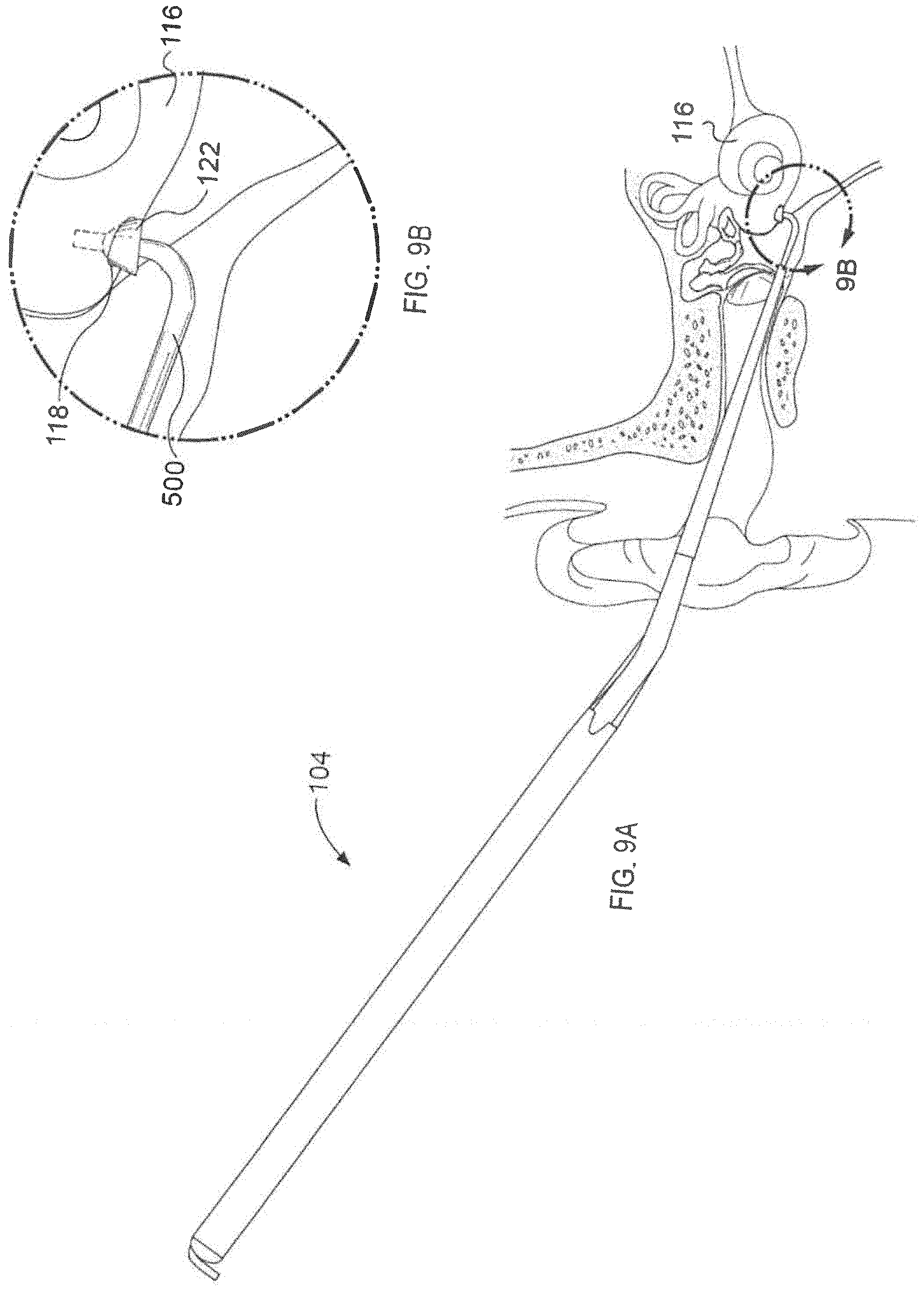 Patent US11771876 Figure 9 – System for inner ear drug delivery via trans-round window membrane injection