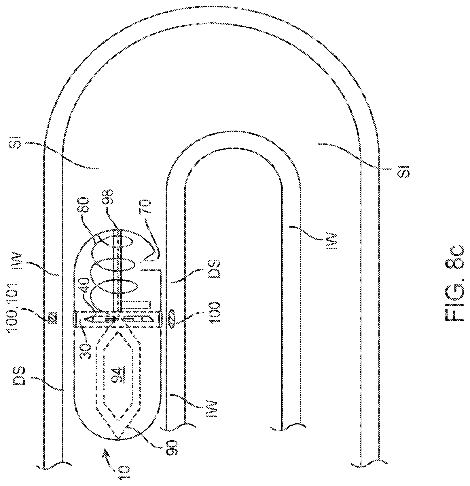 Patent US11771879 Figure 14 – Therapeutic agent preparations for delivery into a lumen of the intestinal tract using a swallowable drug delivery device
