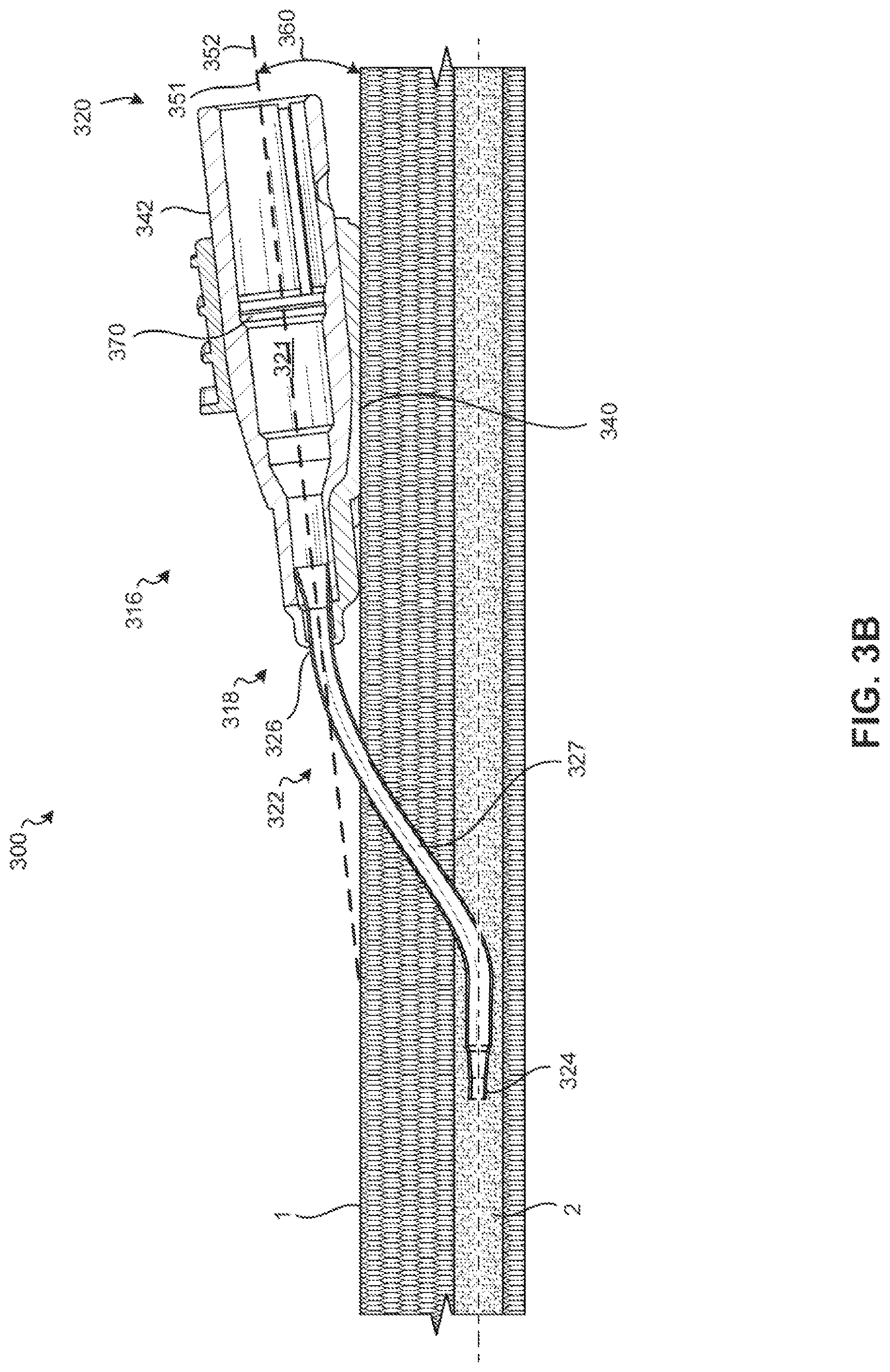 Patent US11771882 Figure 5 – Catheter adapters