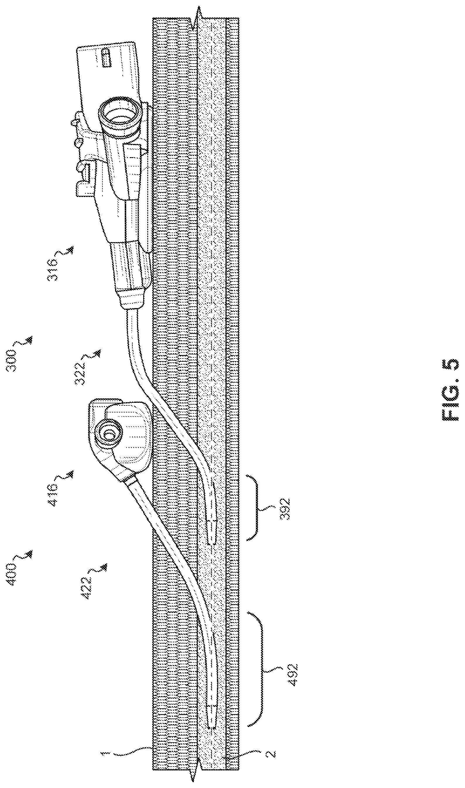Patent US11771882 Figure 8 – Catheter adapters