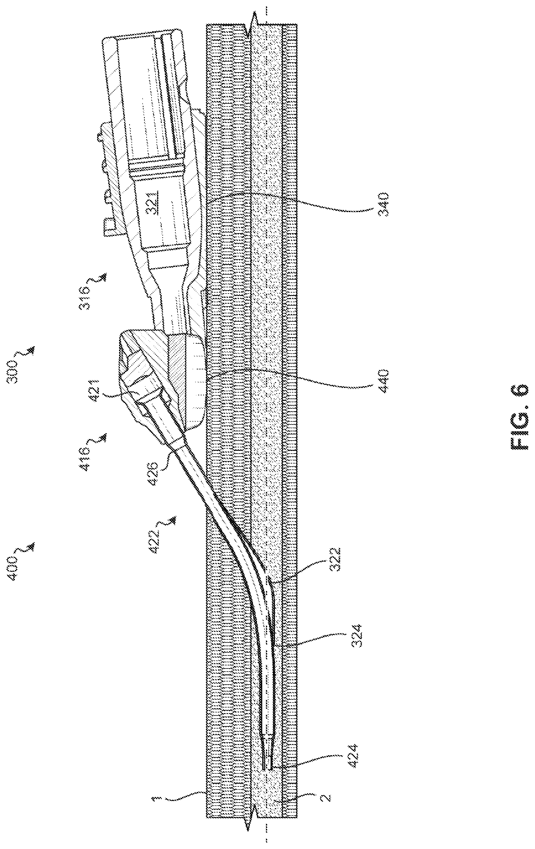 Patent US11771882 Figure 9 – Catheter adapters