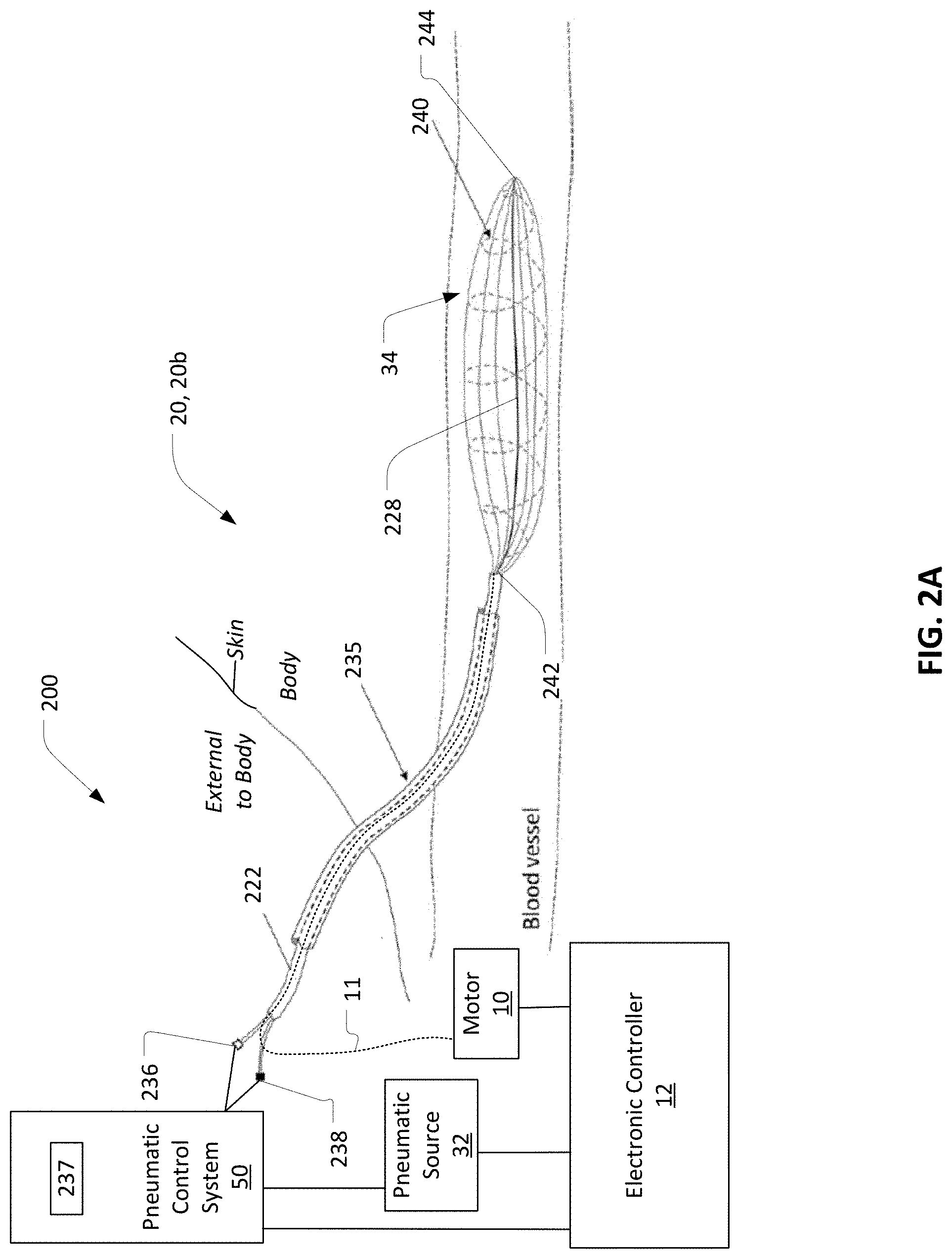 Patent US11771883 Figure 3 – Intravascular membrane oxygenator catheter with oscillating hollow fiber membranes