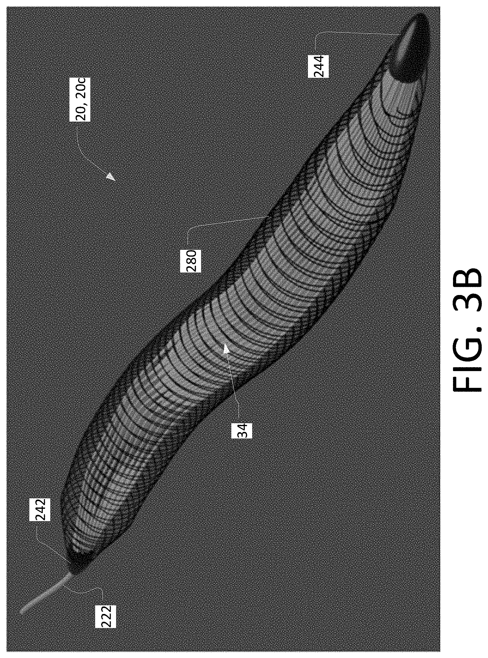 Patent US11771883 Figure 7 – Intravascular membrane oxygenator catheter with oscillating hollow fiber membranes