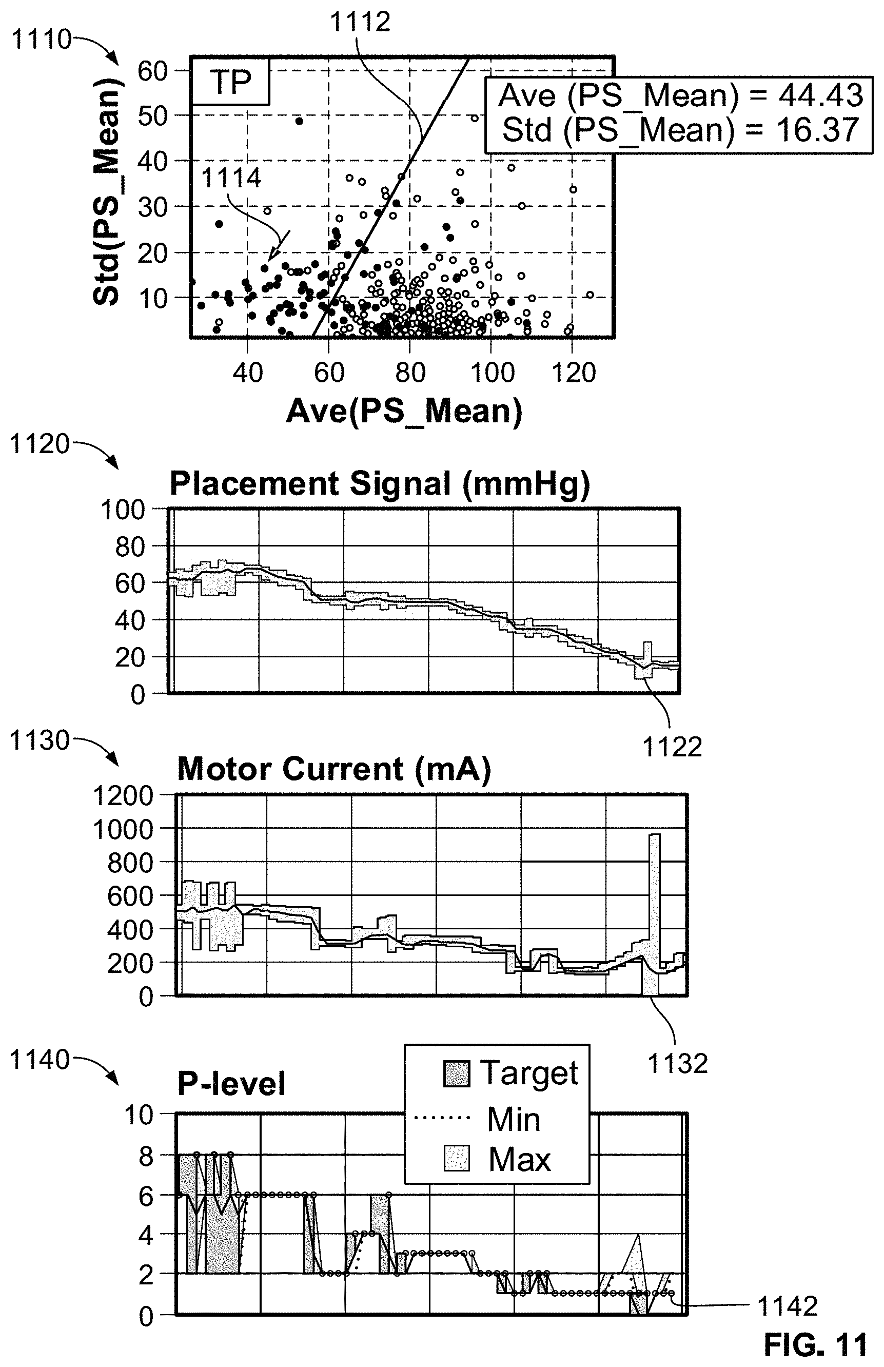 Patent US11771885 Figure 11 – Systems and methods for predicting patient health status