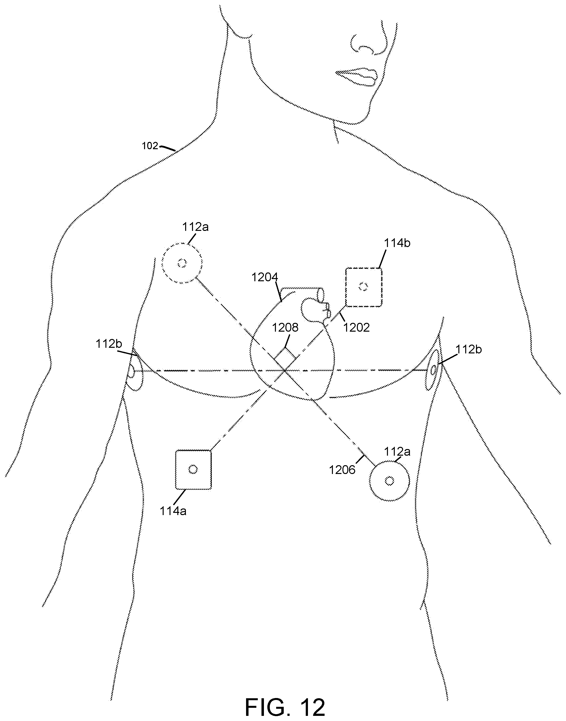 Patent US11771886 Figure 10 – Medical devices with rapid sensor recovery
