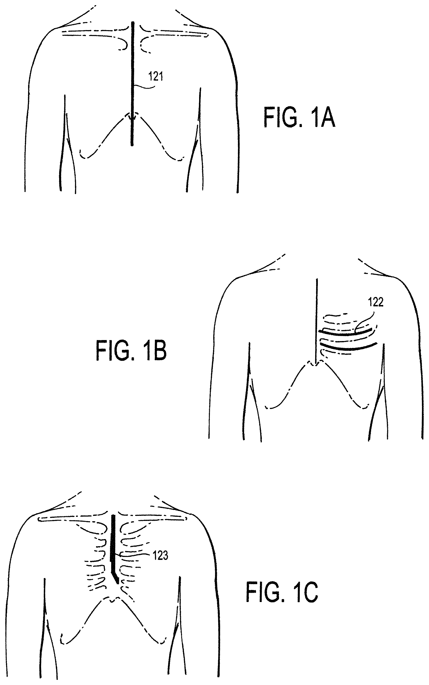 Patent US11771887 Figure 1 – Configurable electrodes and sensors
